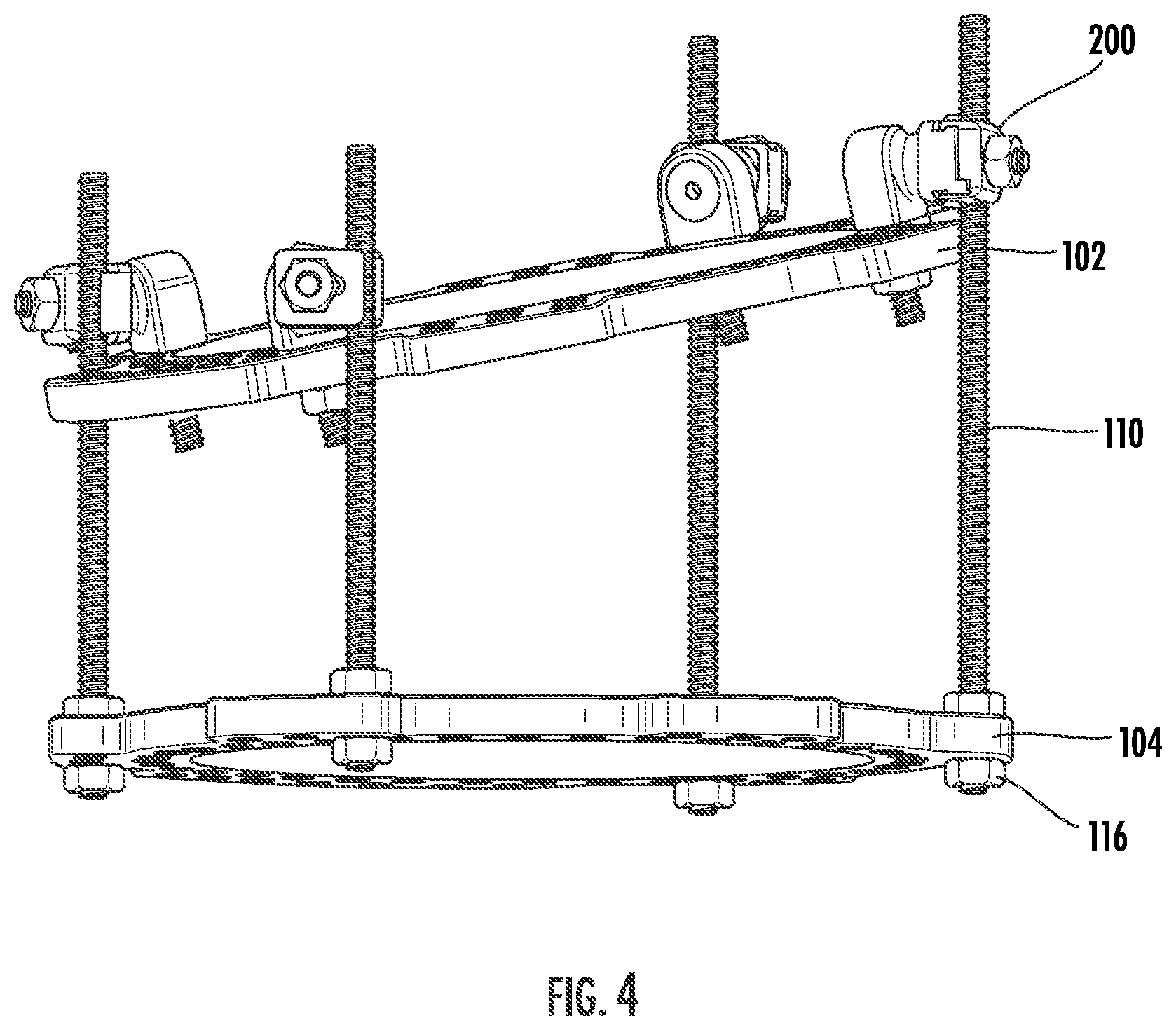 Patent US12396756 Figure 4 – Conversion kit for an external fixation system