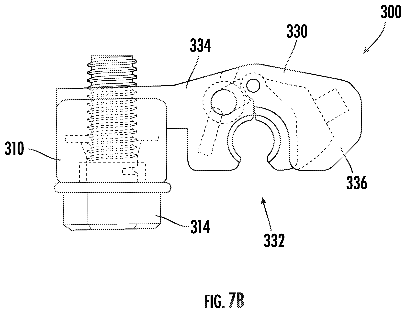 Patent US12396756 Figure 9 – Conversion kit for an external fixation system