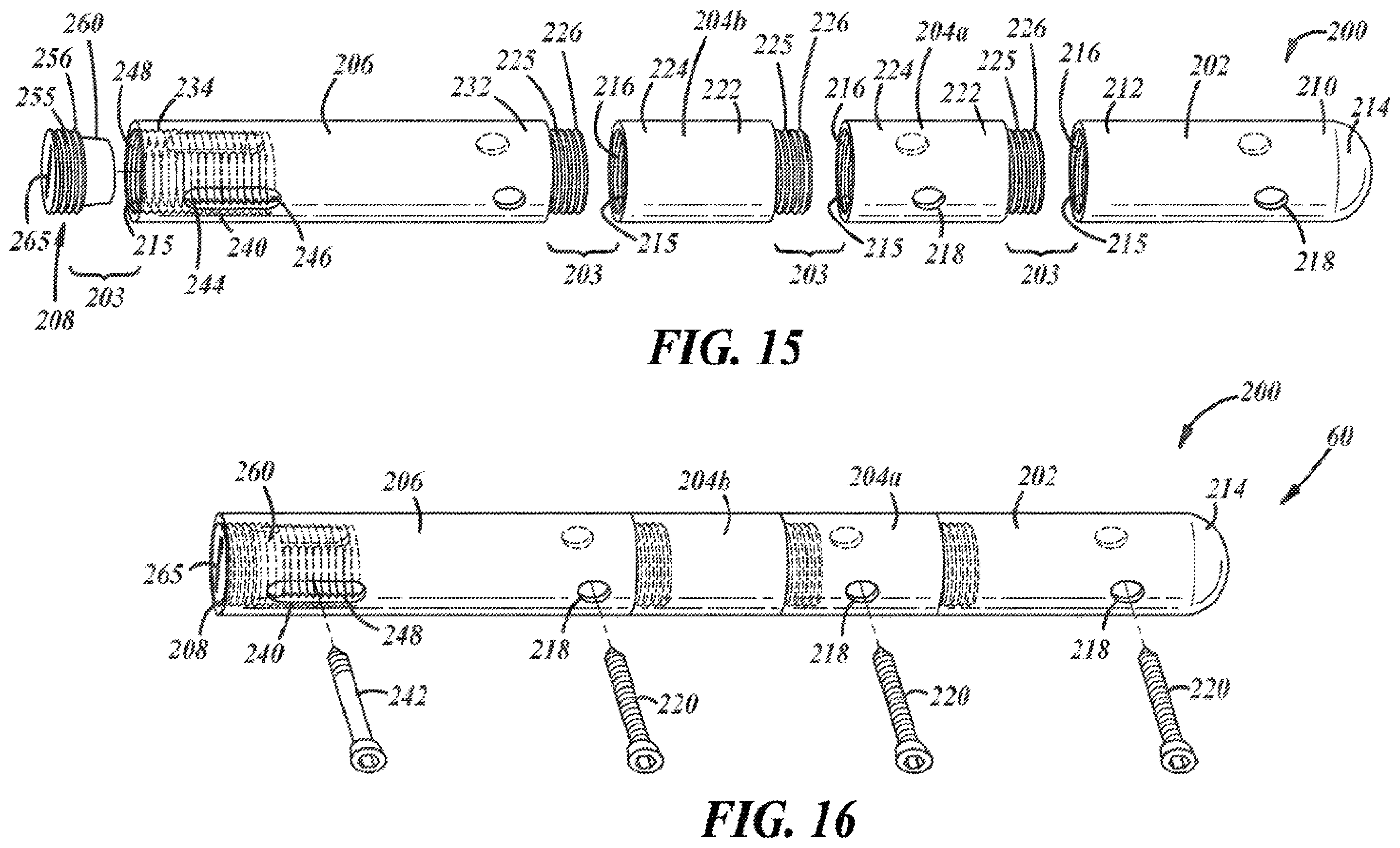 Patent US12396757 Figure 8 – Implants and methods for treating Charcot foot and other conditions