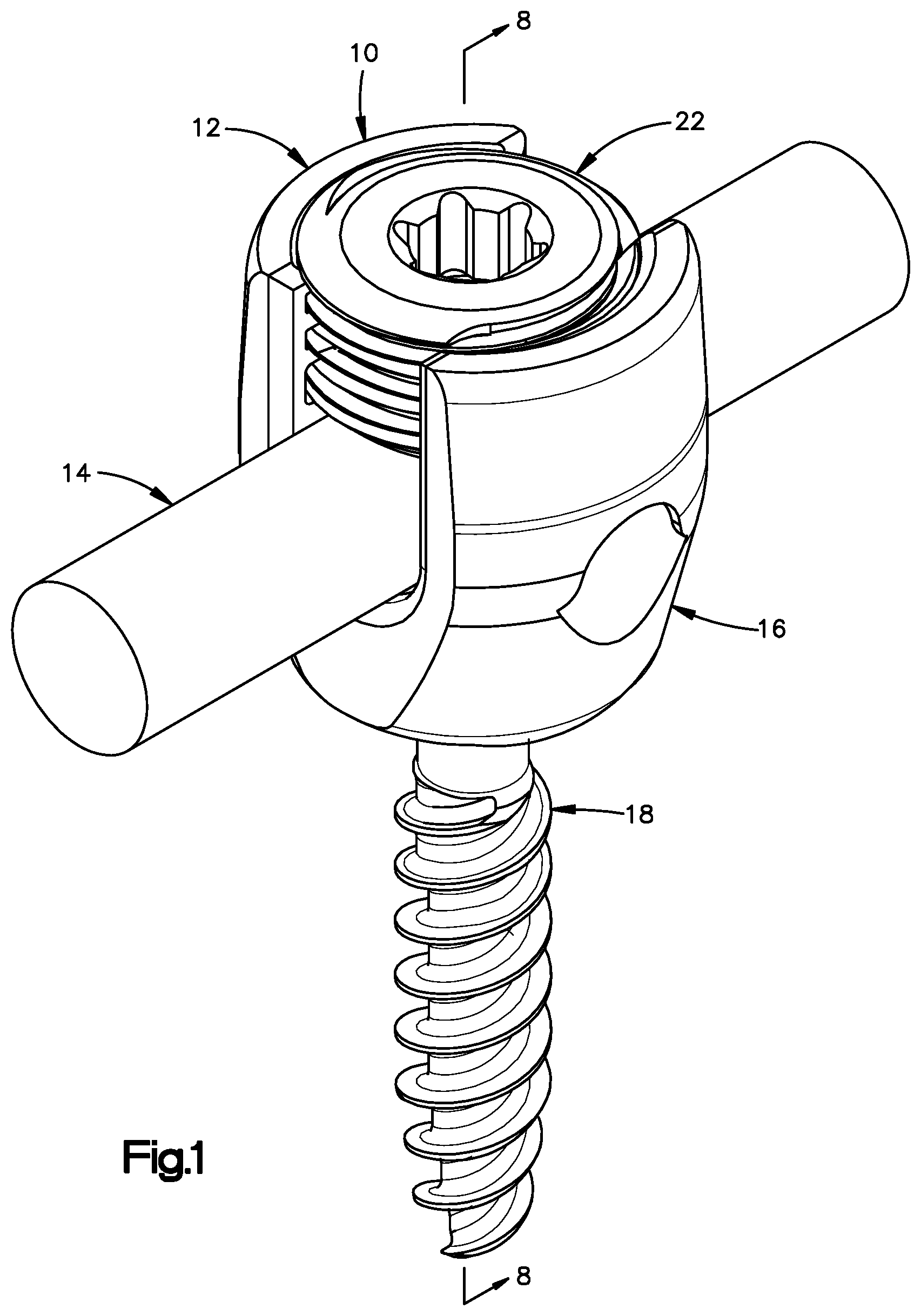Patent US12396758 Figure 1 – Polyaxial bone fixation element