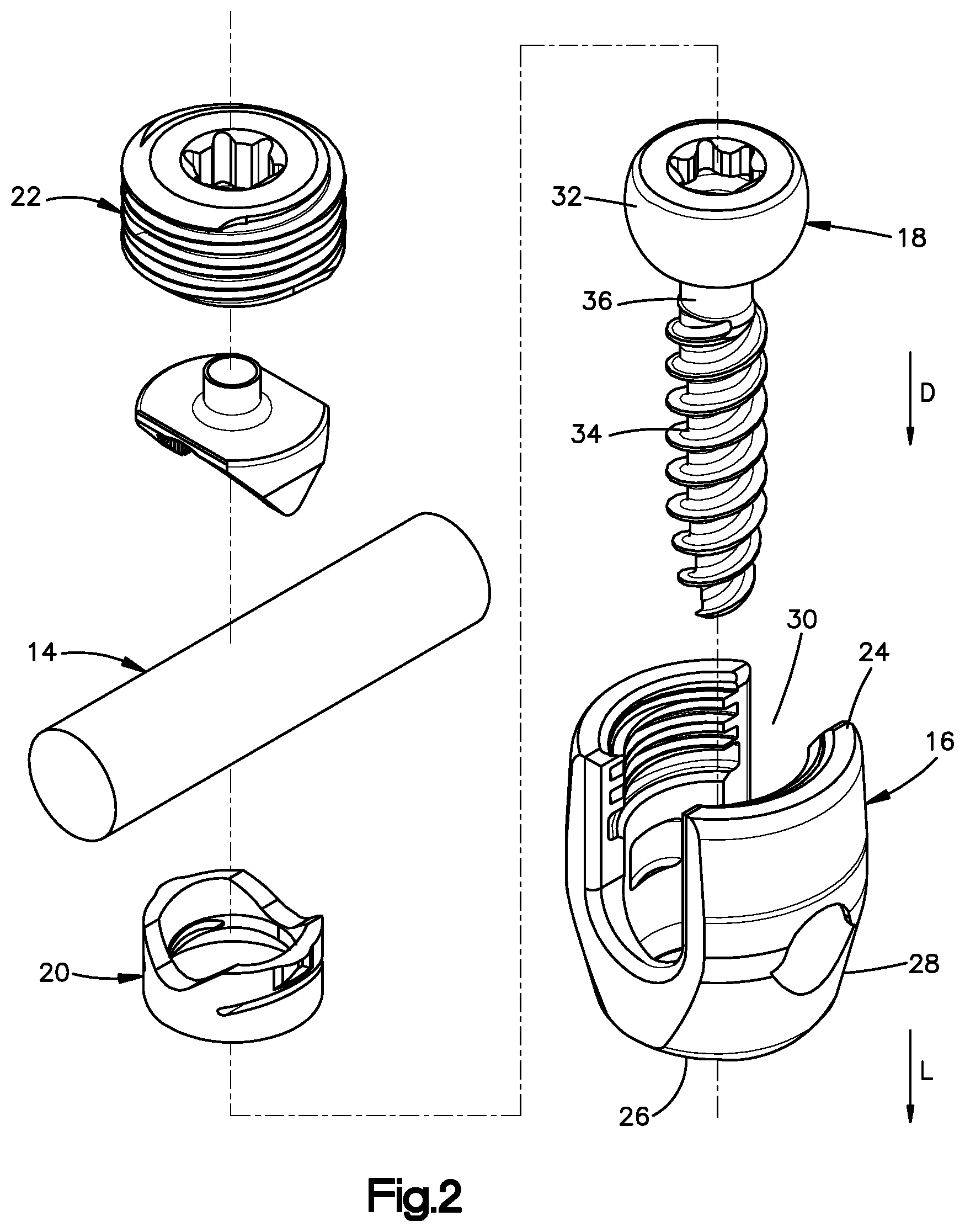 Patent US12396758 Figure 2 – Polyaxial bone fixation element