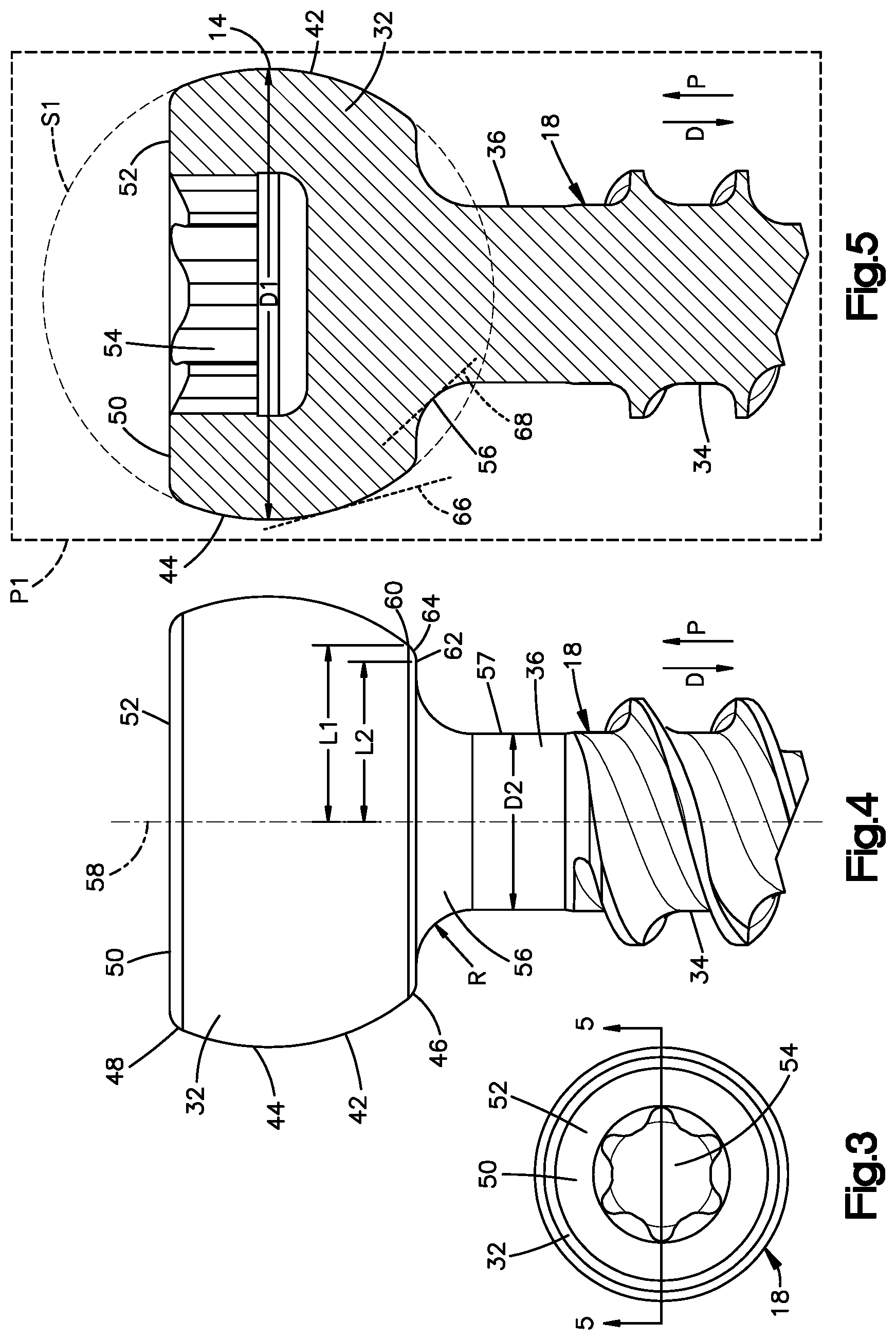 Patent US12396758 Figure 3 – Polyaxial bone fixation element