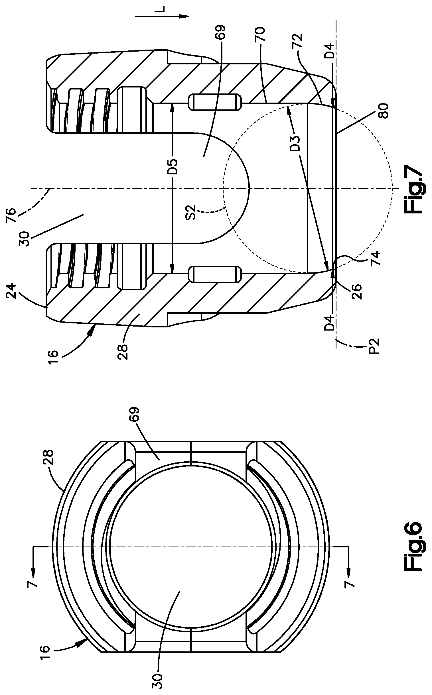 Patent US12396758 Figure 4 – Polyaxial bone fixation element