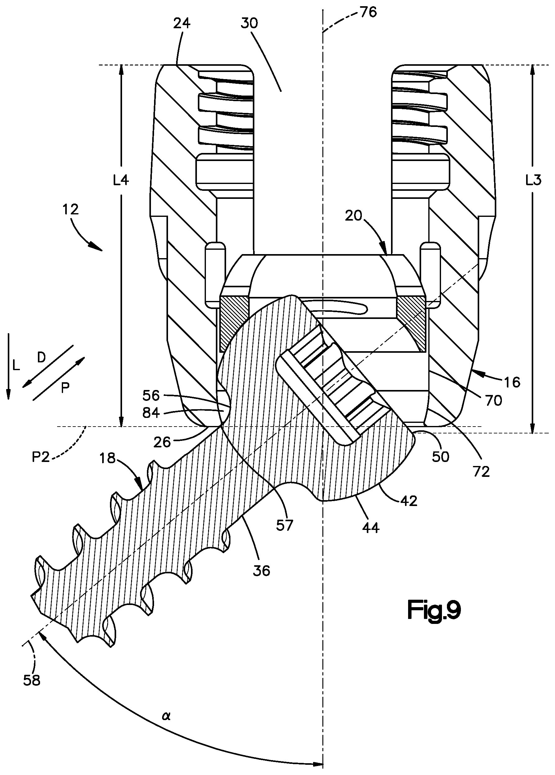 Patent US12396758 Figure 6 – Polyaxial bone fixation element