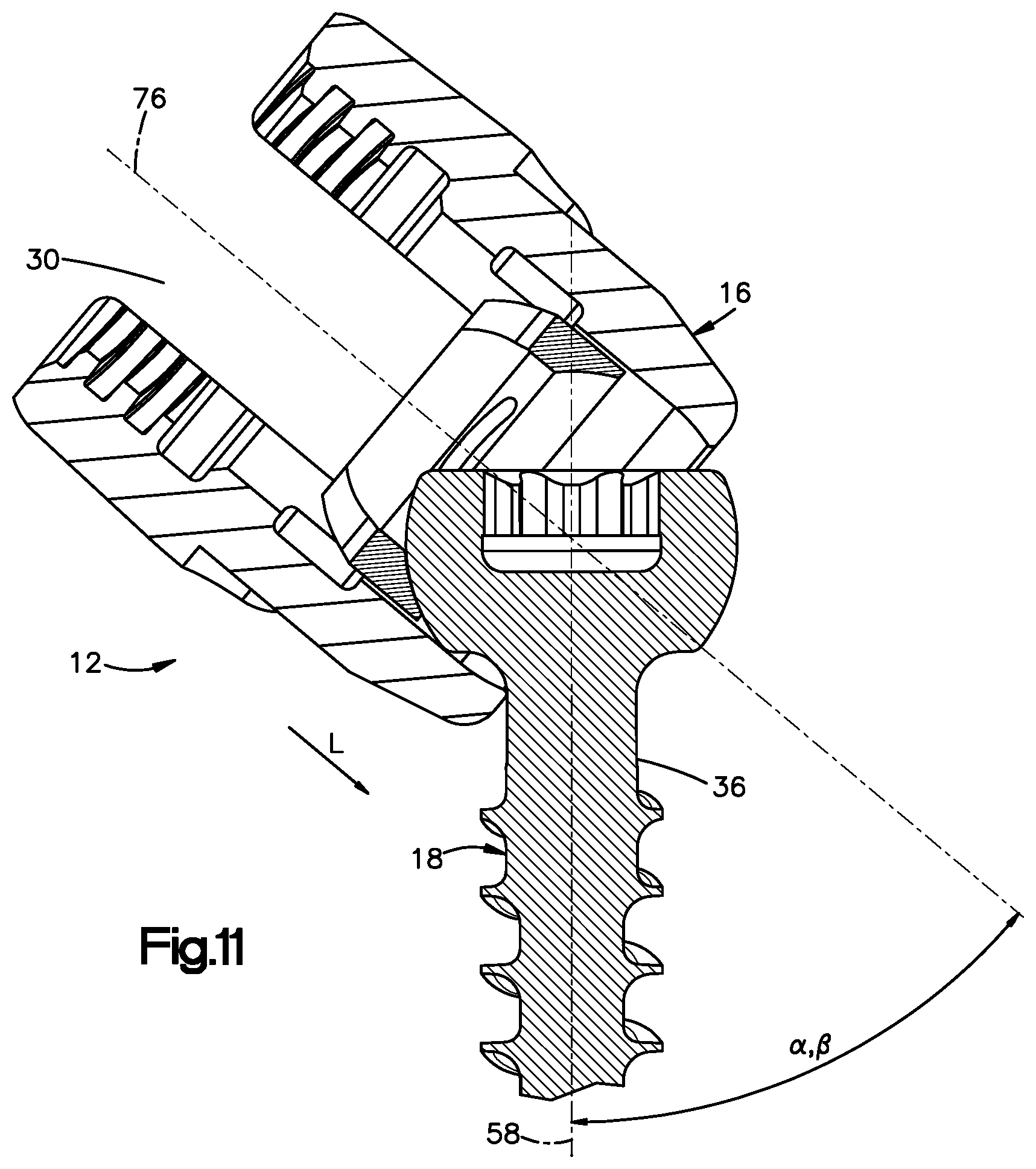 Patent US12396758 Figure 8 – Polyaxial bone fixation element