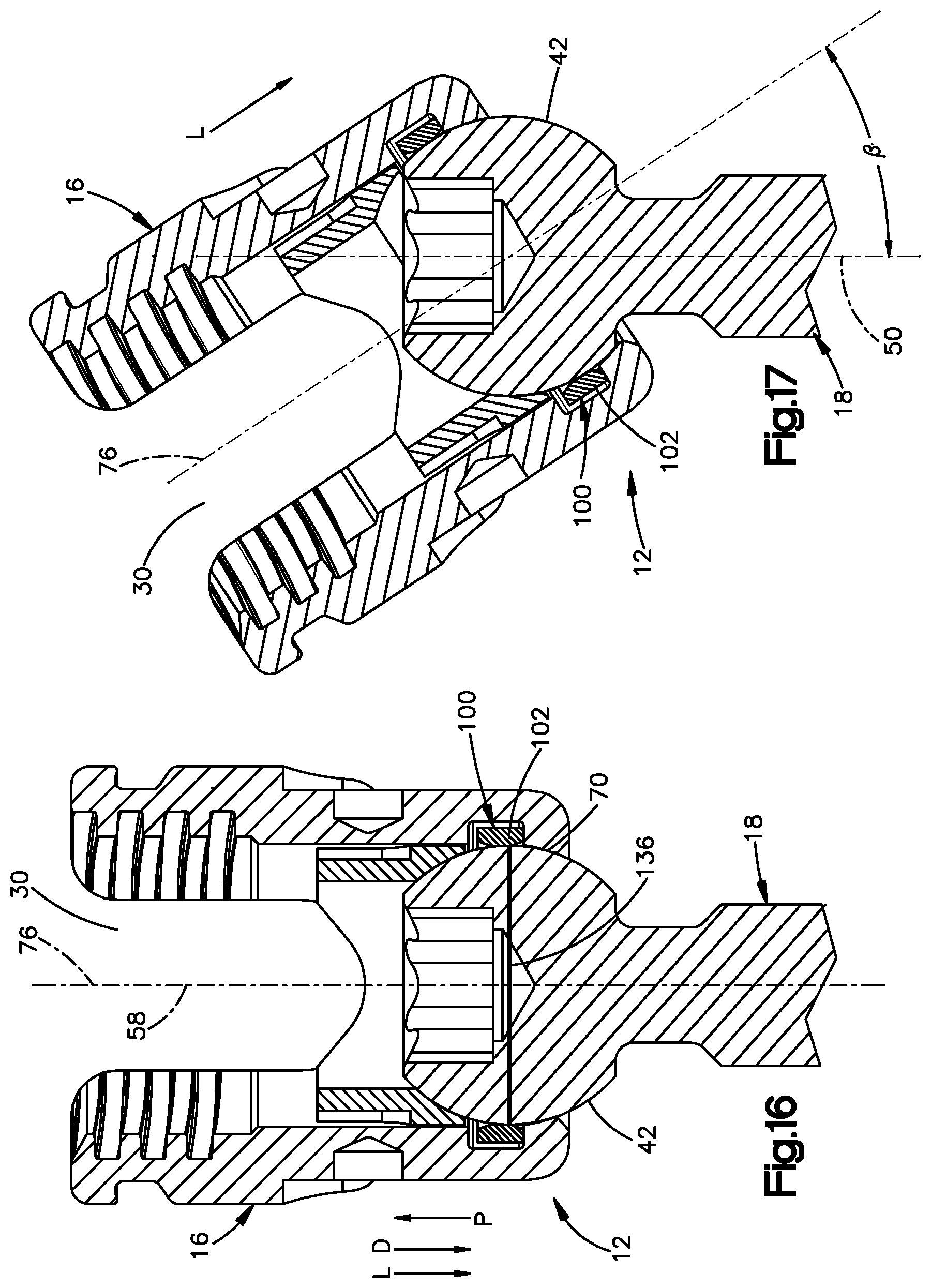 Patent US12396758 Figure 12 – Polyaxial bone fixation element