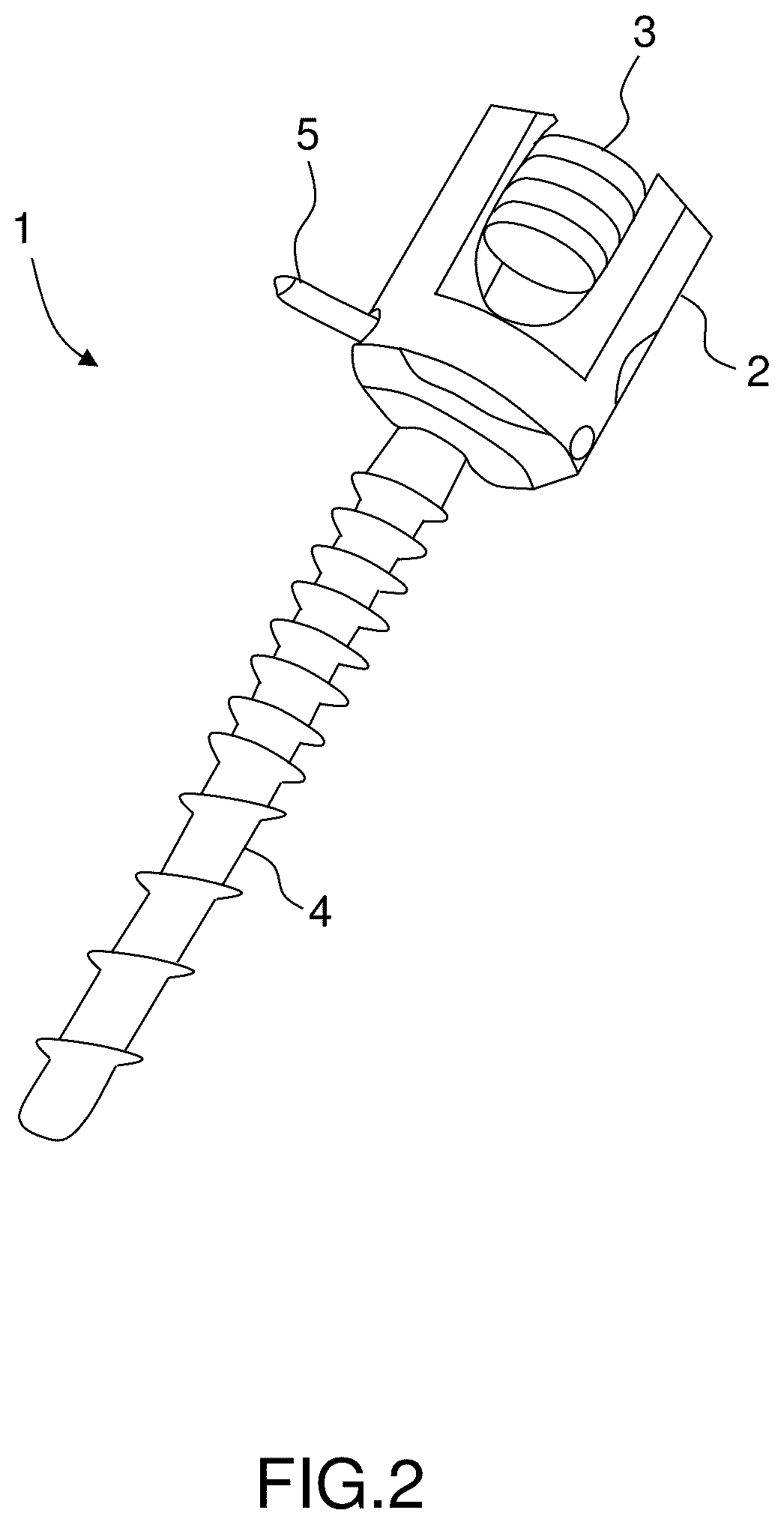 Patent US12396760 Figure 2 – Orthopedic implant kit
