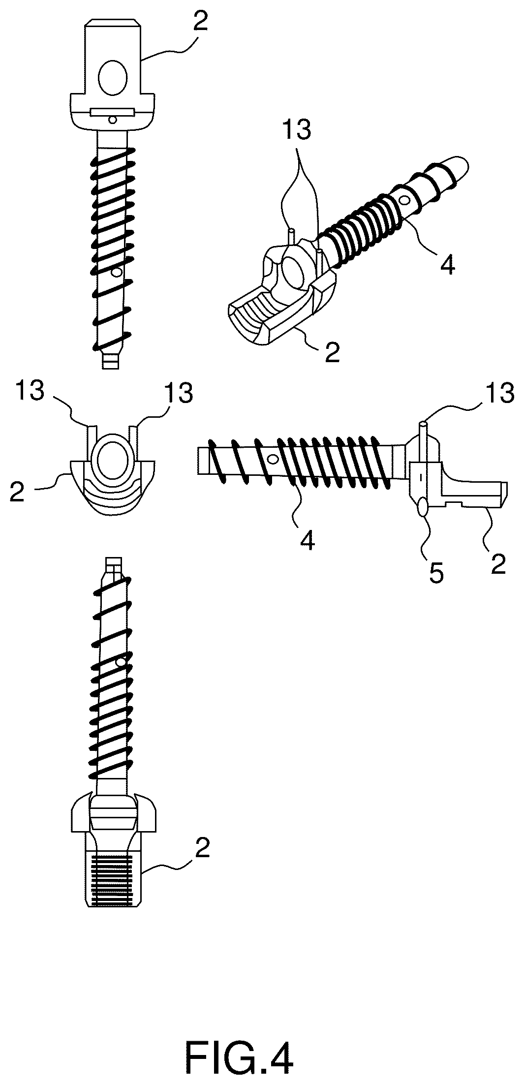 Patent US12396760 Figure 4 – Orthopedic implant kit