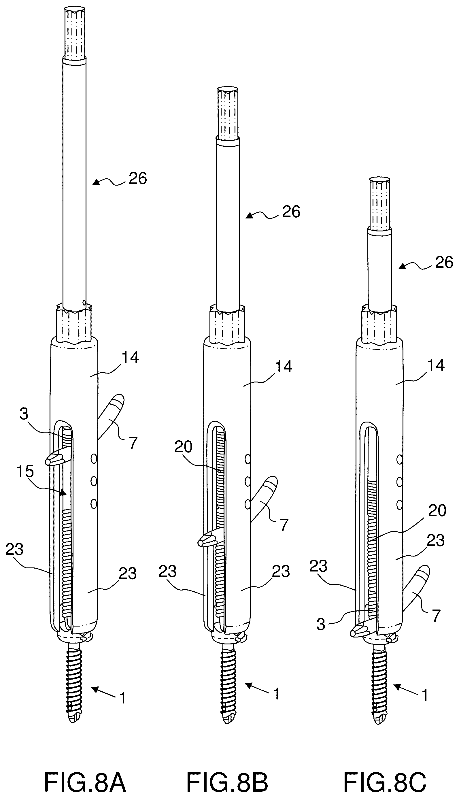Patent US12396760 Figure 6 – Orthopedic implant kit