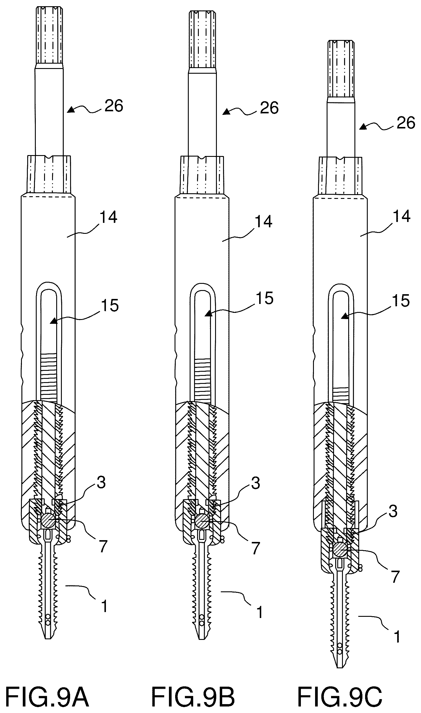 Patent US12396760 Figure 7 – Orthopedic implant kit