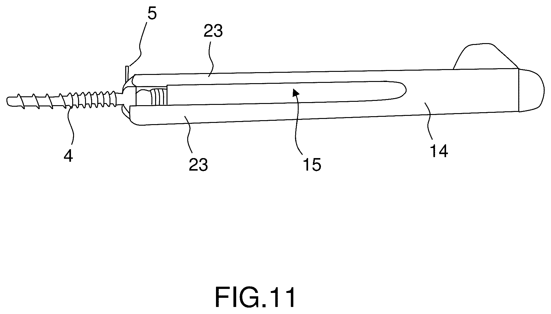 Patent US12396760 Figure 9 – Orthopedic implant kit