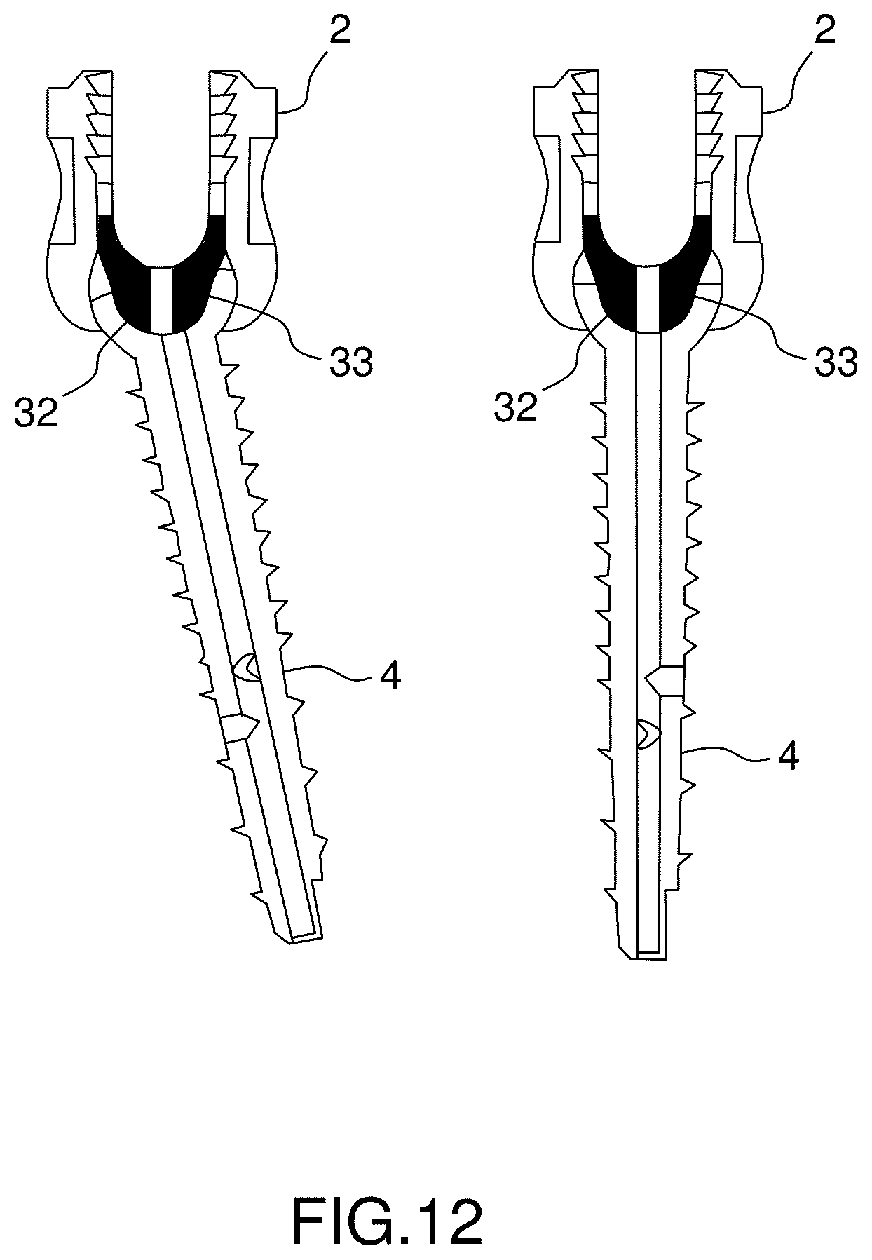 Patent US12396760 Figure 10 – Orthopedic implant kit