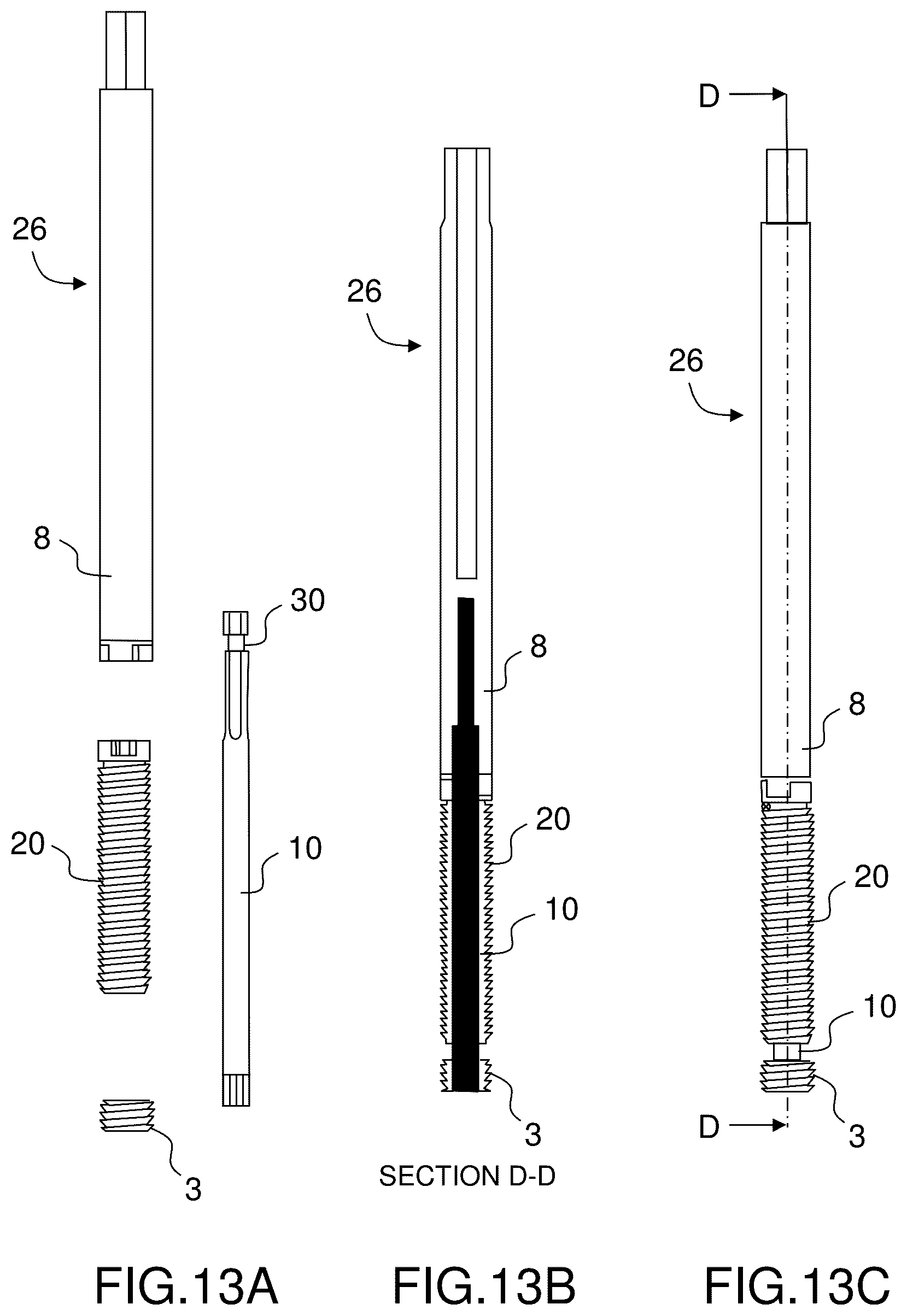 Patent US12396760 Figure 11 – Orthopedic implant kit