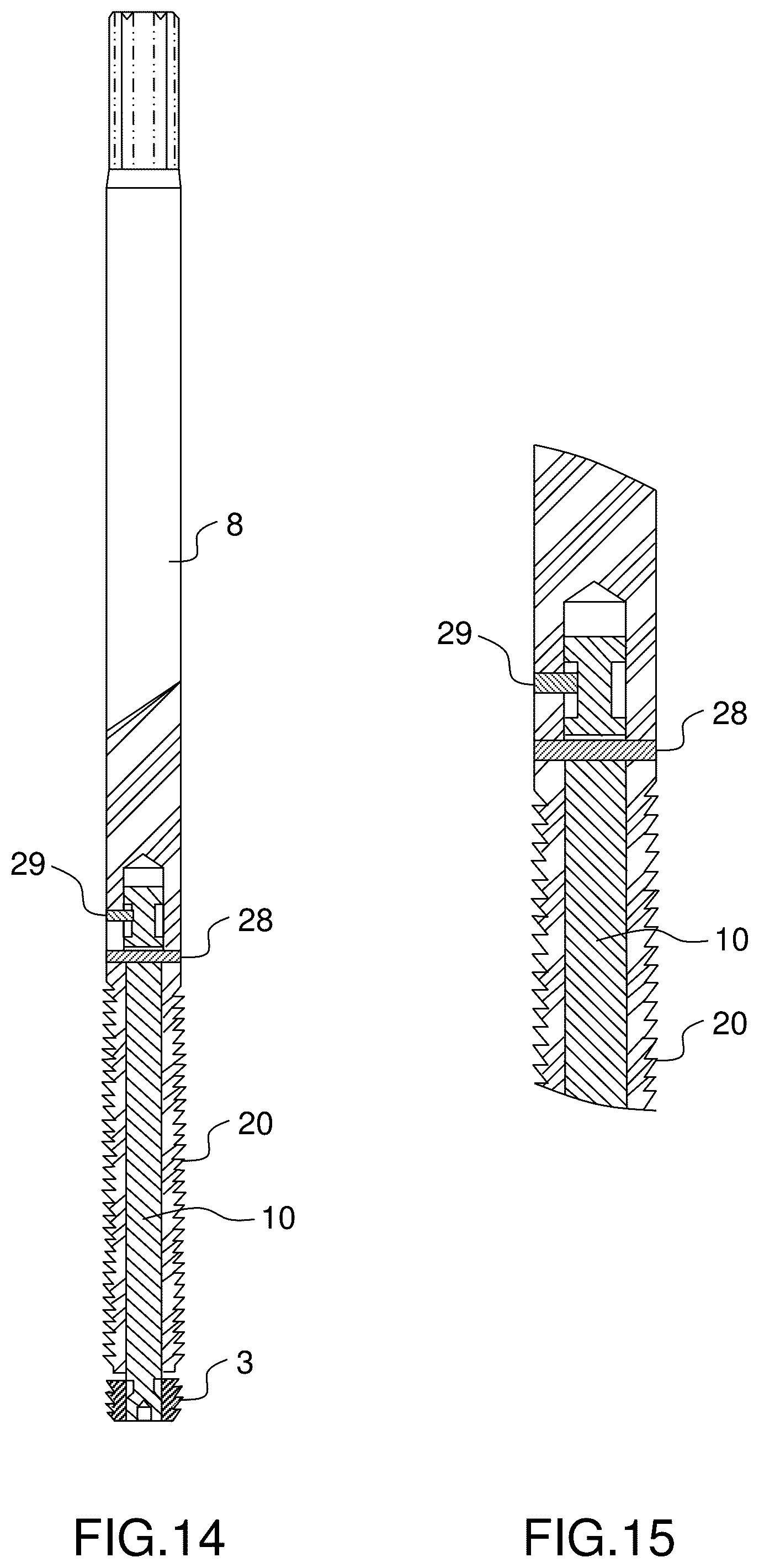 Patent US12396760 Figure 12 – Orthopedic implant kit