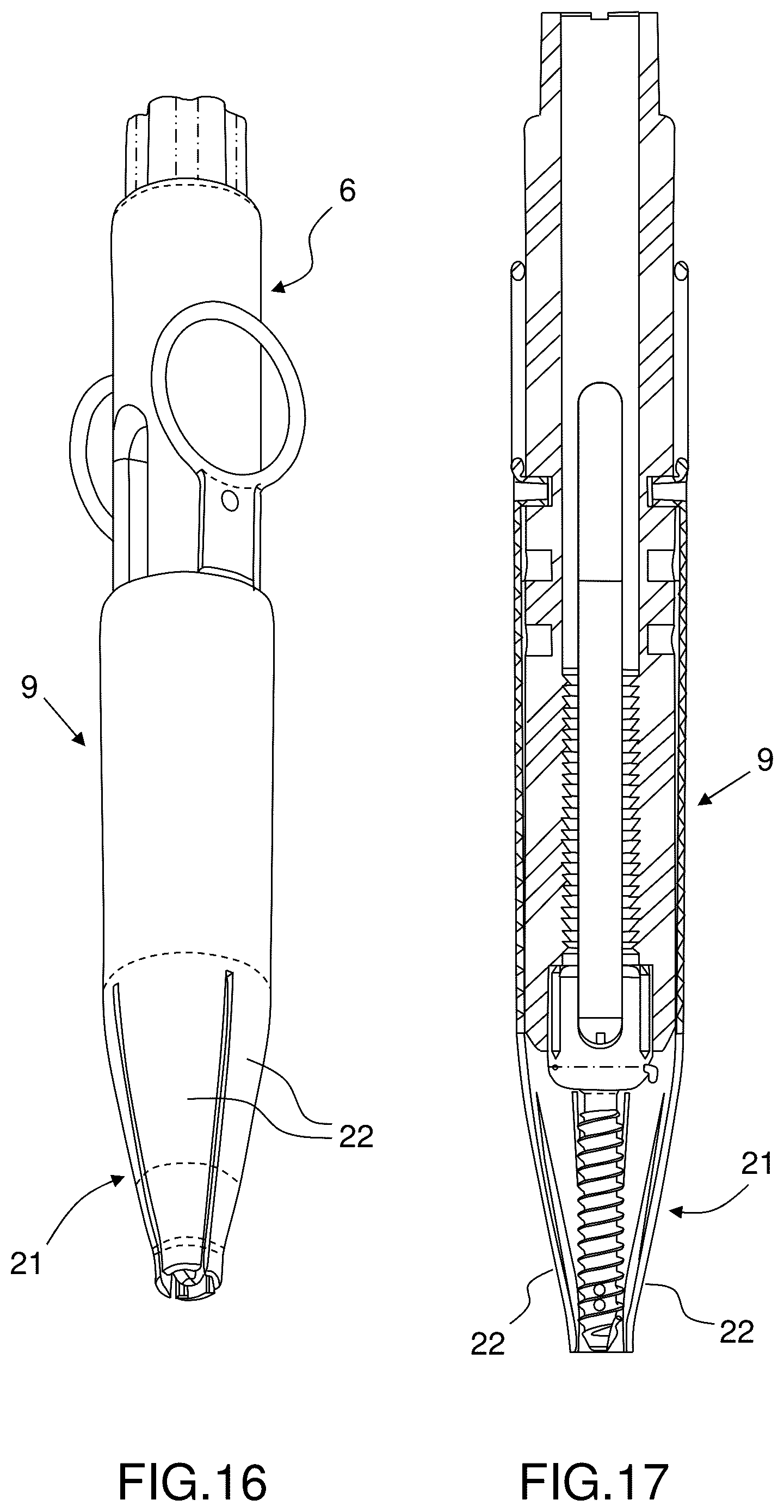Patent US12396760 Figure 13 – Orthopedic implant kit