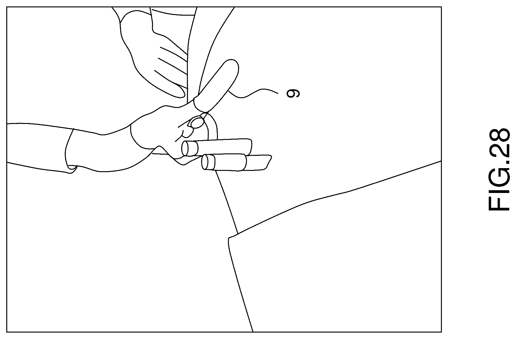 Patent US12396760 Figure 19 – Orthopedic implant kit