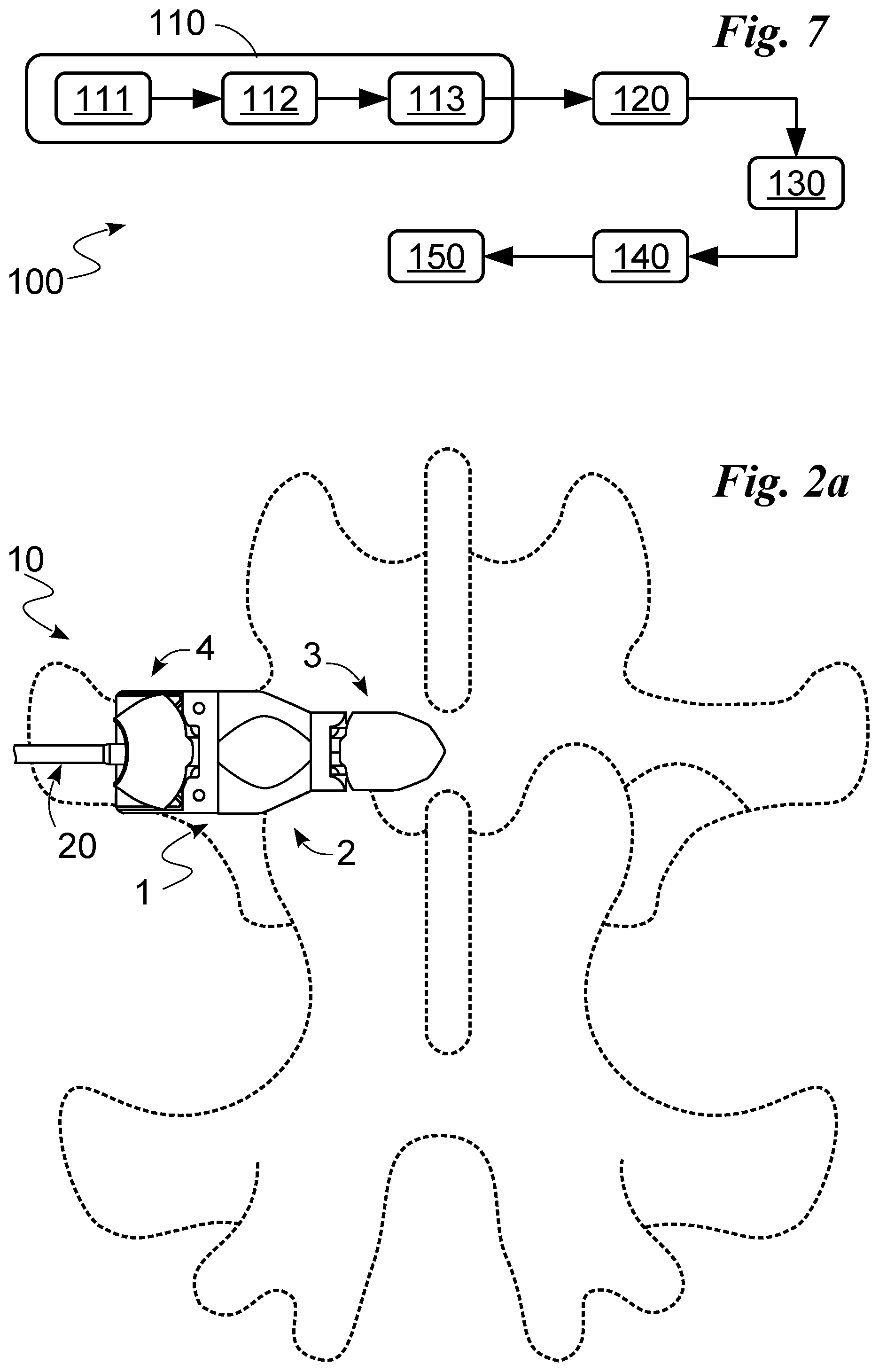 Patent US12396762 Figure 2 – Interspinous vertebral distractor