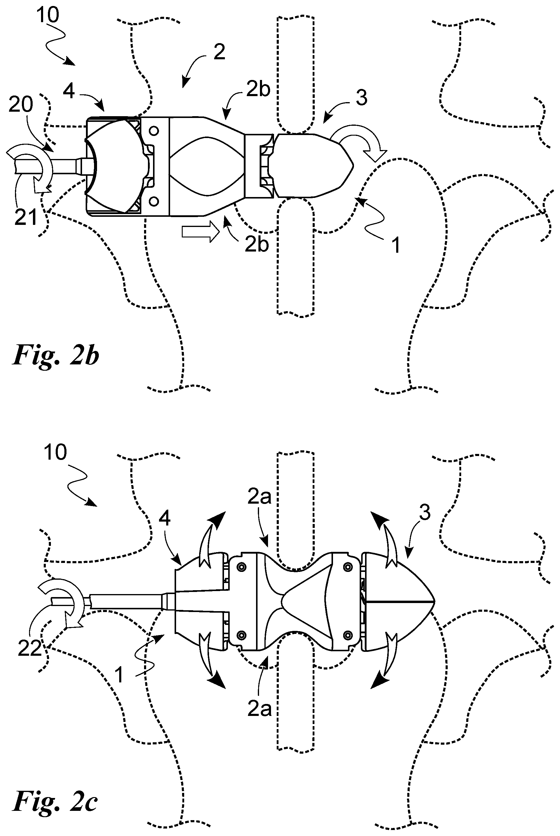 Patent US12396762 Figure 3 – Interspinous vertebral distractor