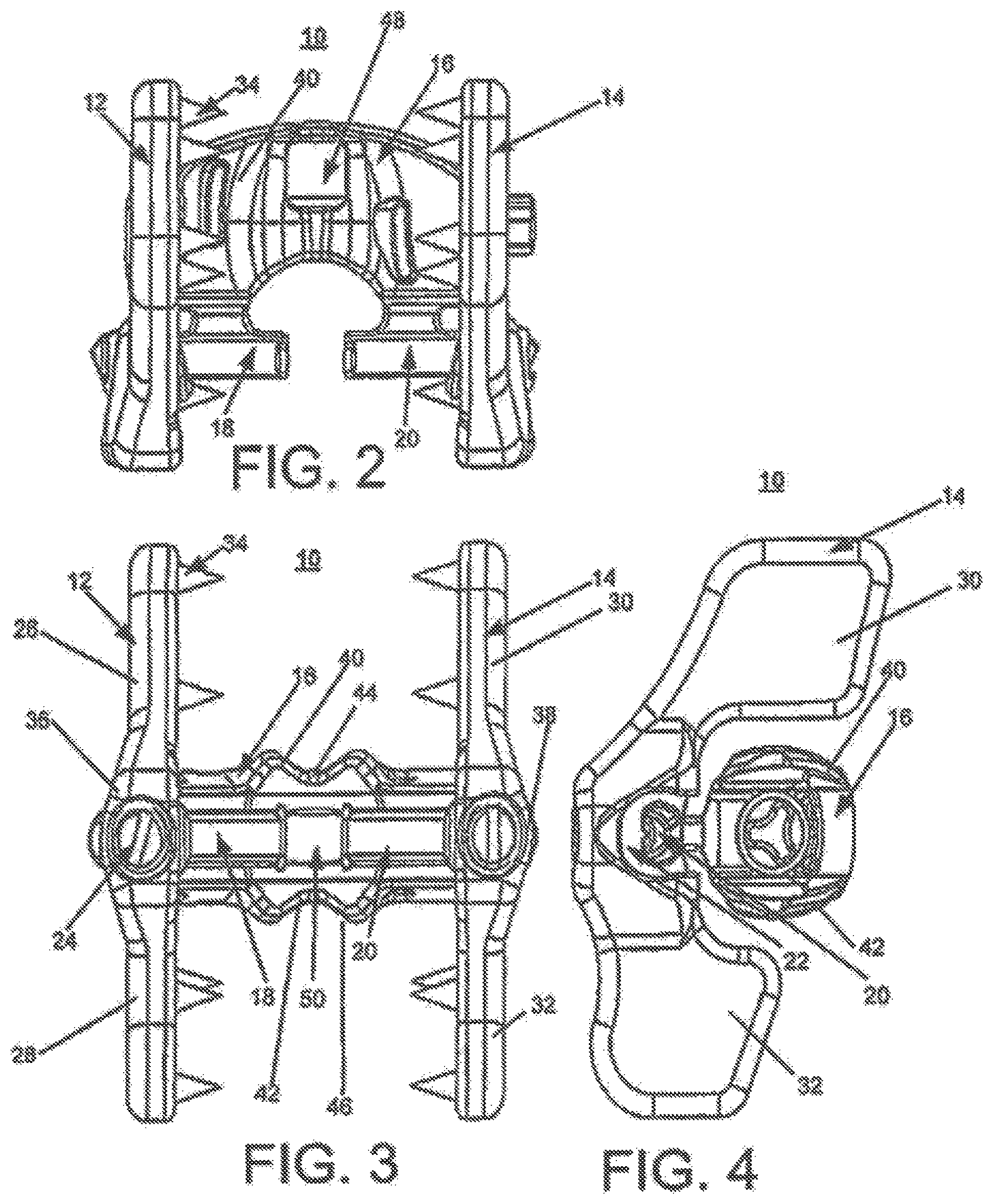 Patent US12396763 Figure 2 – Spinous process fixation system and methods thereof