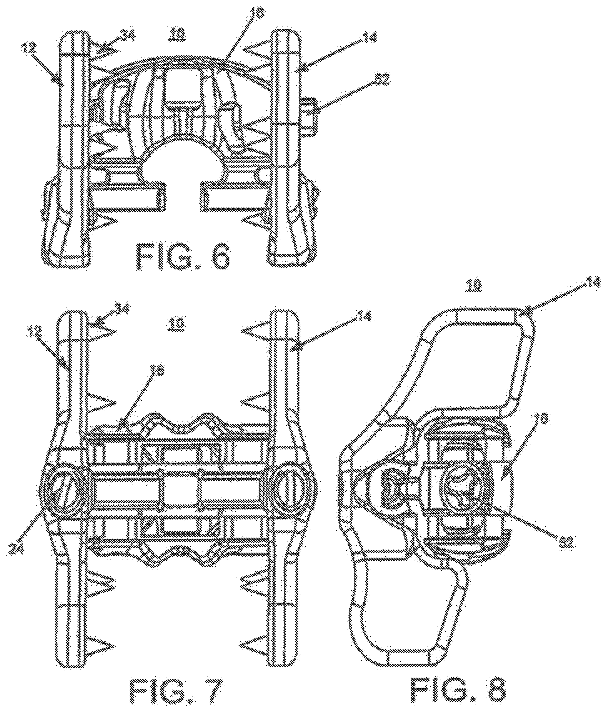 Patent US12396763 Figure 4 – Spinous process fixation system and methods thereof