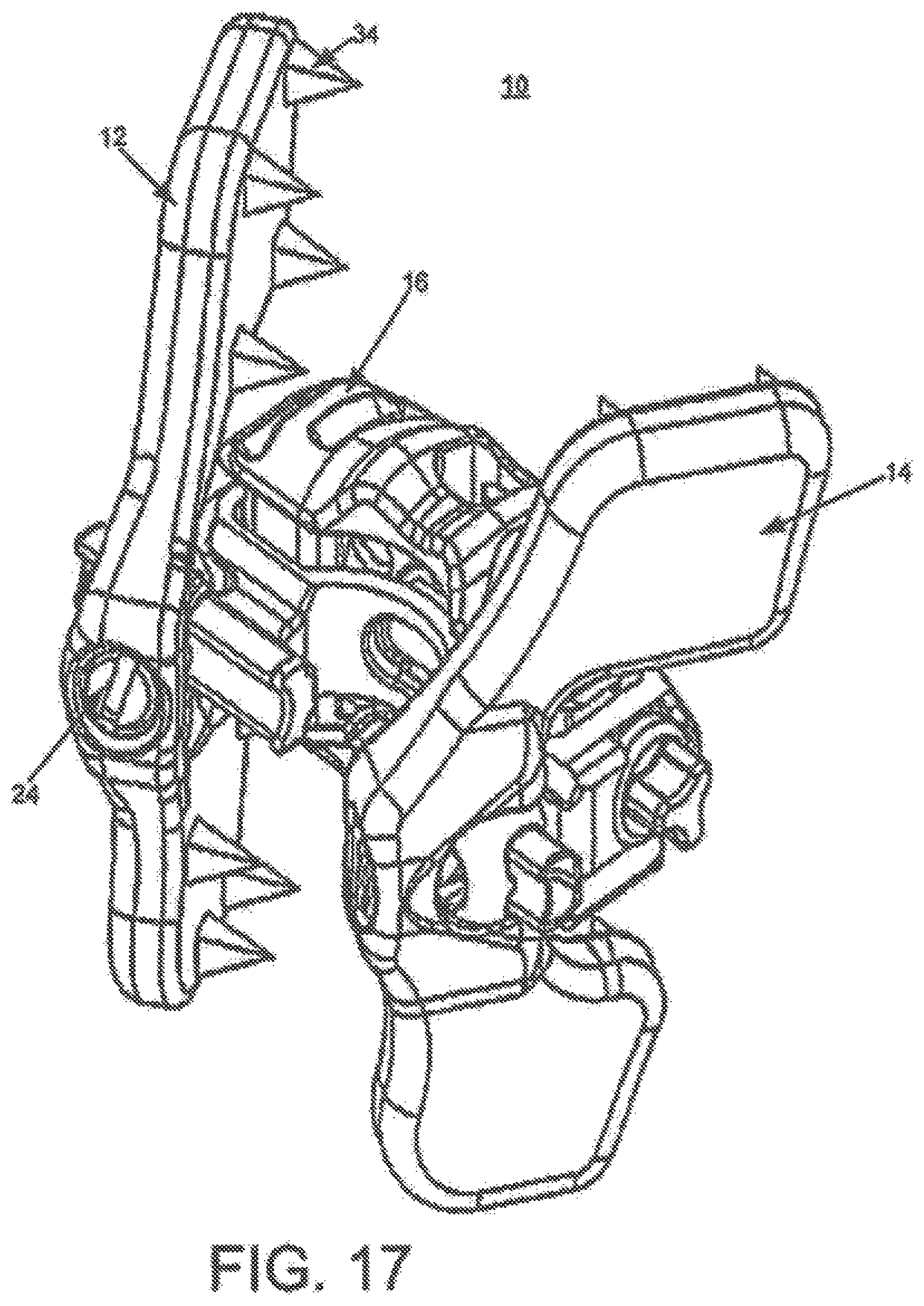 Patent US12396763 Figure 9 – Spinous process fixation system and methods thereof