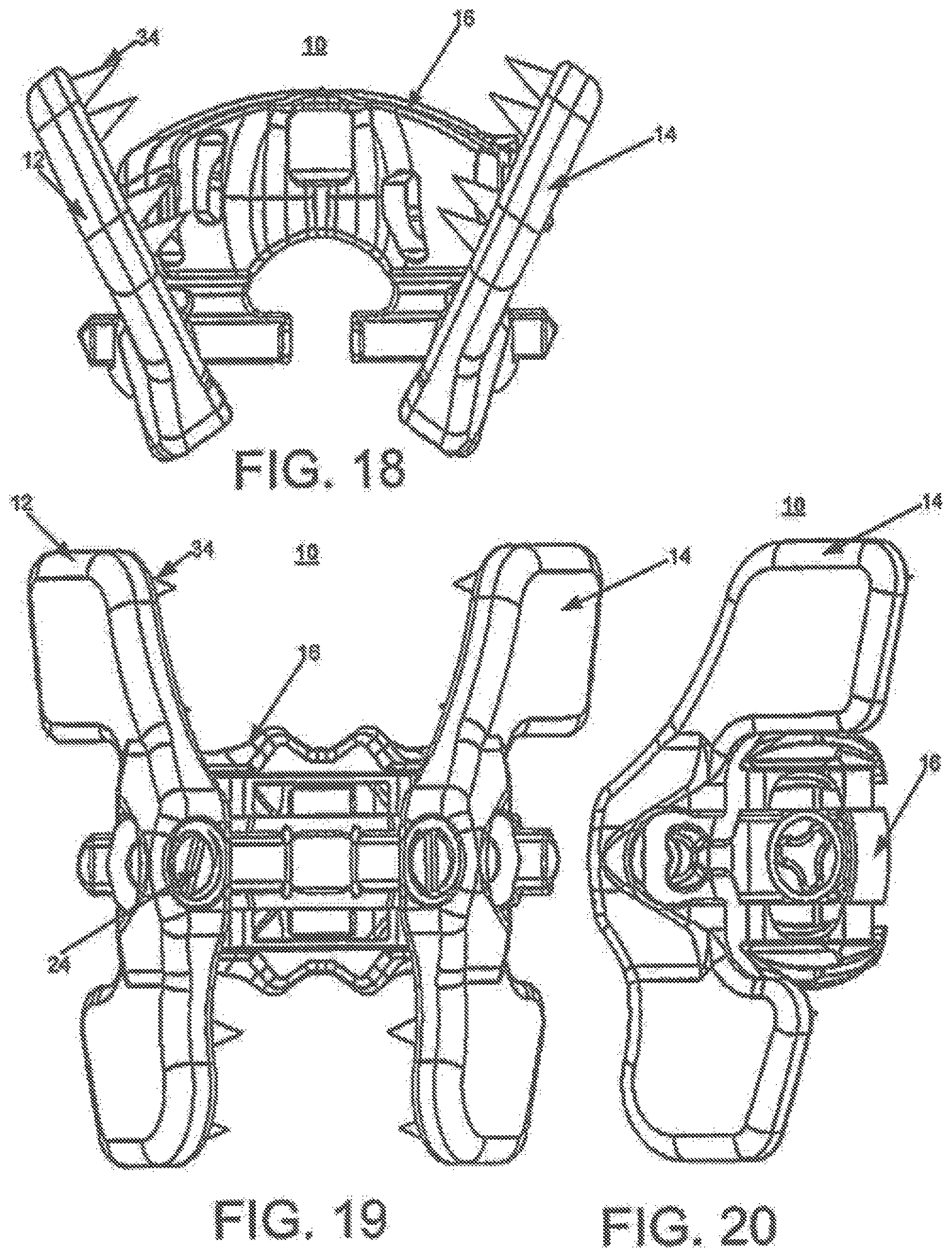 Patent US12396763 Figure 10 – Spinous process fixation system and methods thereof