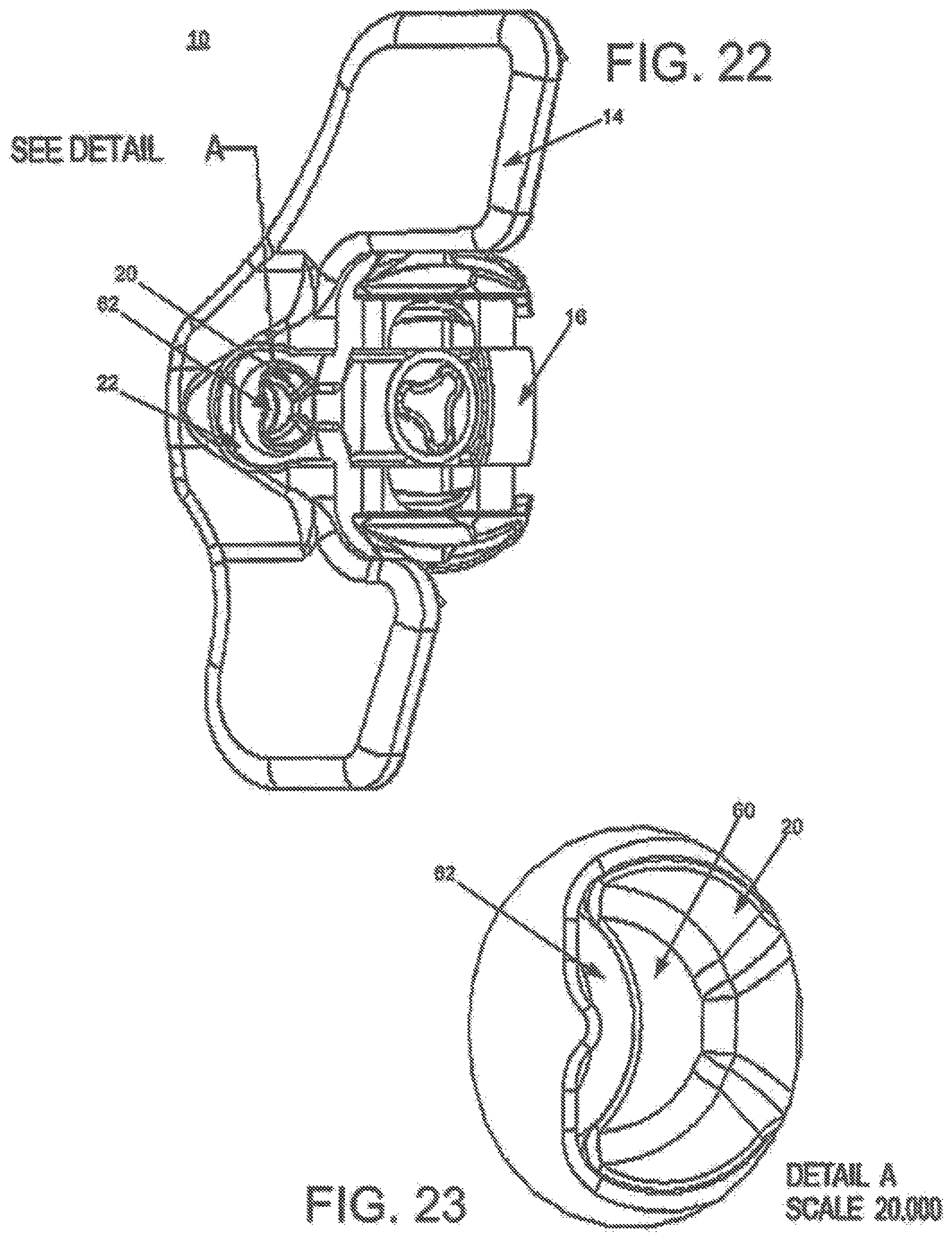 Patent US12396763 Figure 12 – Spinous process fixation system and methods thereof