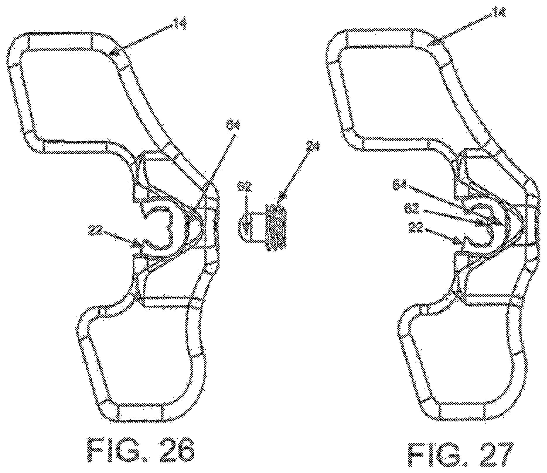 Patent US12396763 Figure 14 – Spinous process fixation system and methods thereof