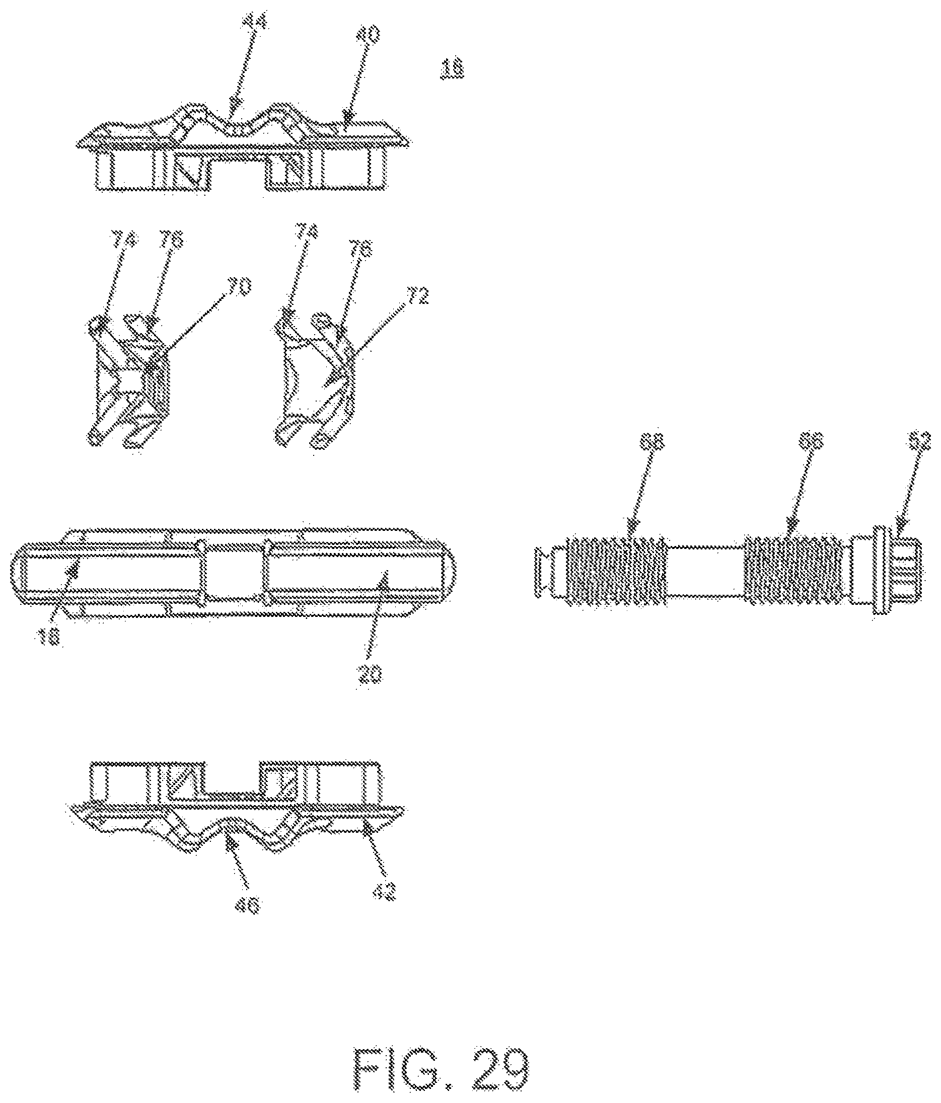 Patent US12396763 Figure 16 – Spinous process fixation system and methods thereof