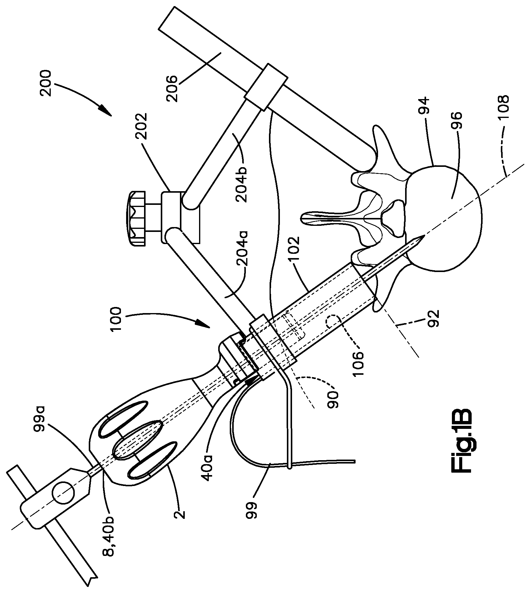 Patent US12396764 Figure 2 – Control member for adjusting access tube position, and related systems and methods