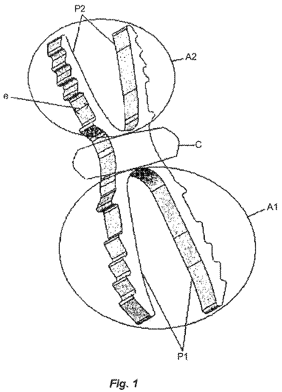 Patent US12396766 Figure 1 – Osteosynthesis device