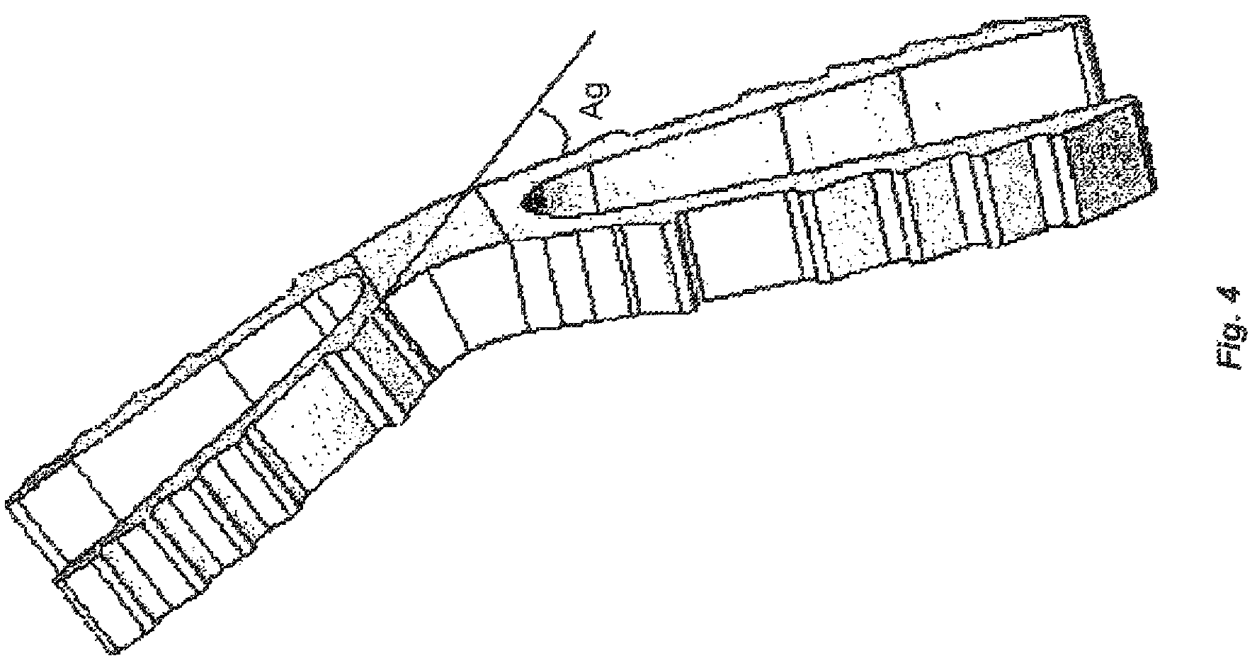 Patent US12396766 Figure 4 – Osteosynthesis device