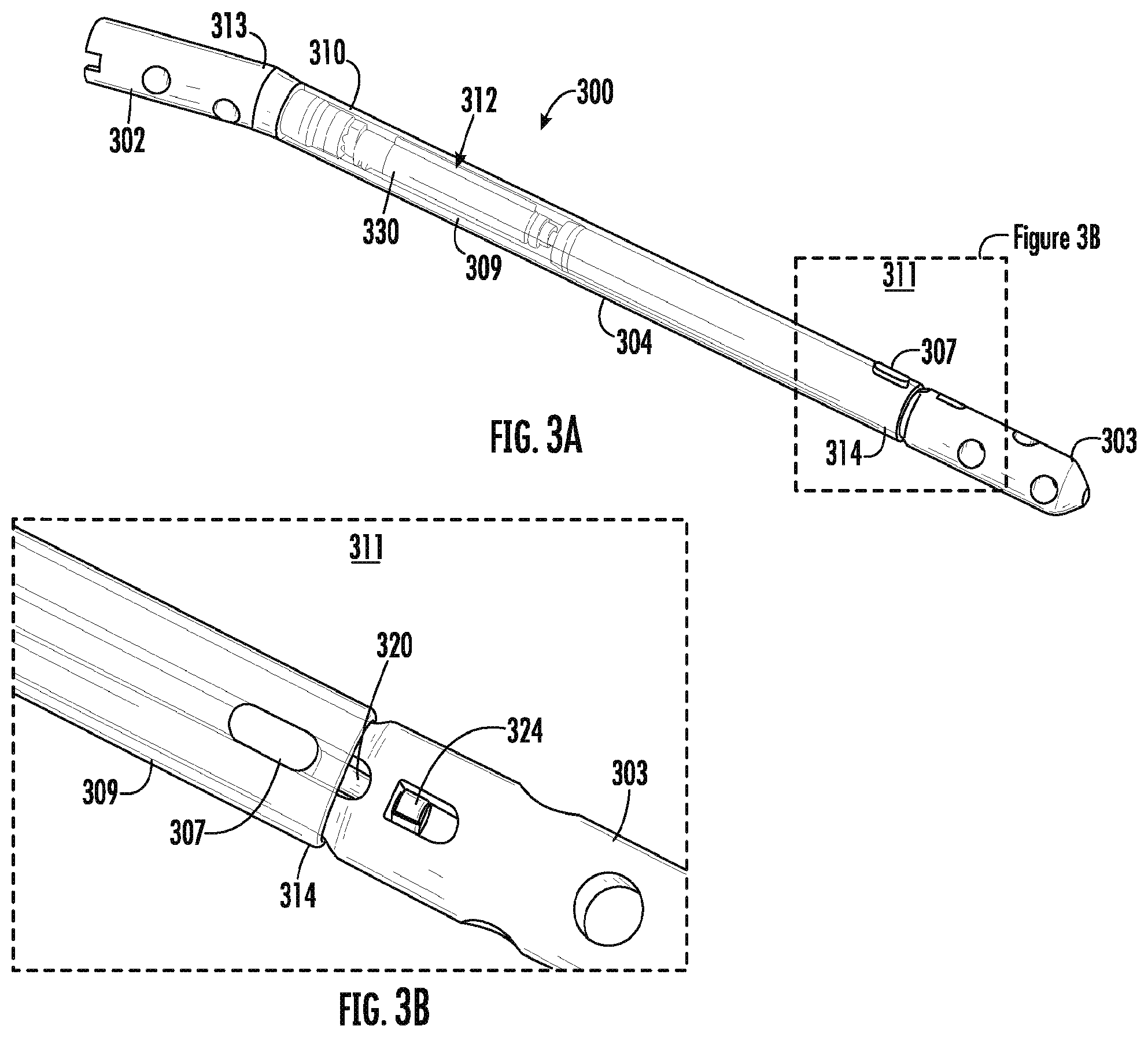 Patent US12396767 Figure 3 – Implantable motorized bone adjustment devices