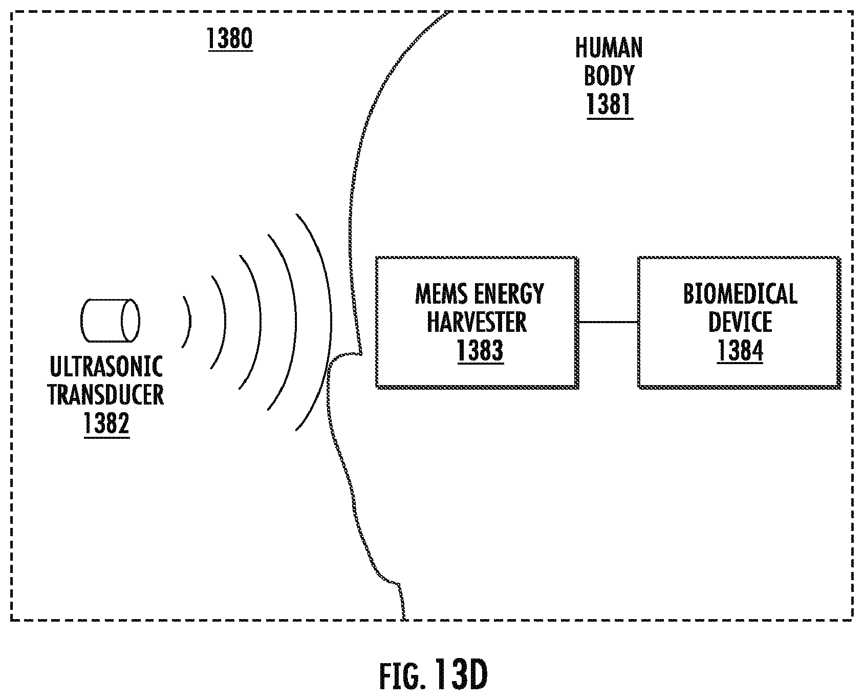 Patent US12396767 Figure 19 – Implantable motorized bone adjustment devices