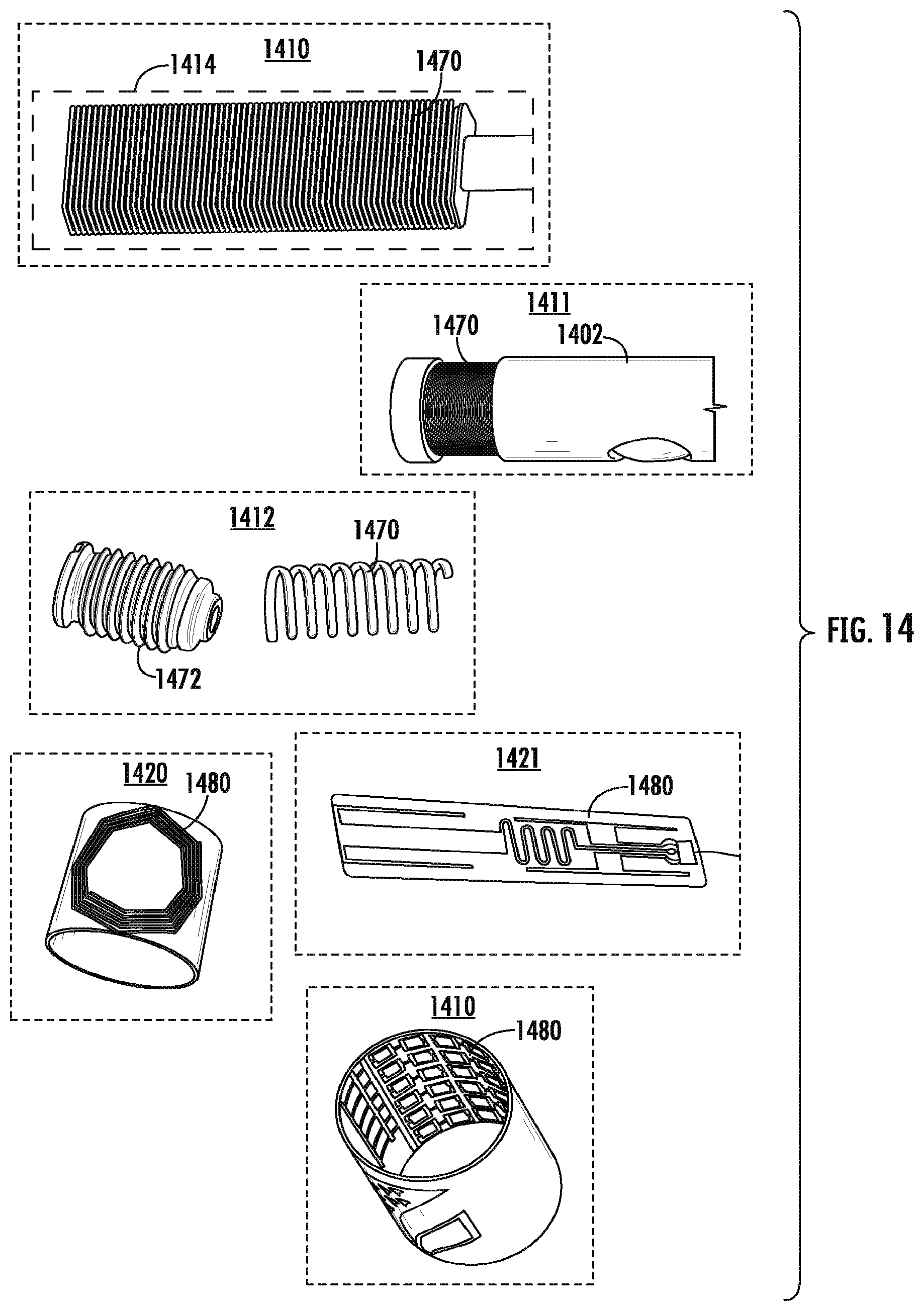 Patent US12396767 Figure 20 – Implantable motorized bone adjustment devices