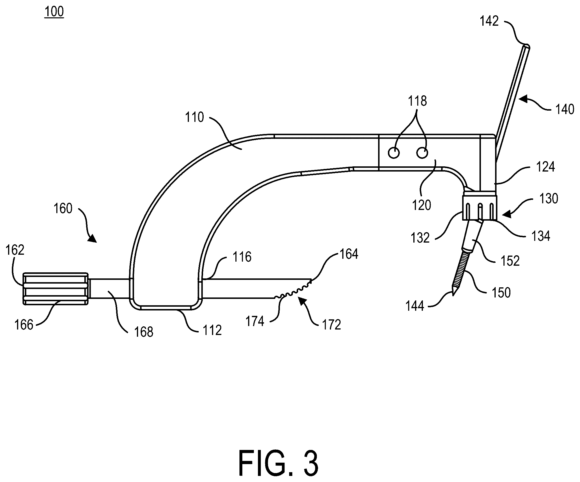 Patent US12396768 Figure 3 – Intramedullary nail alignment guides, fixation guides, devices, systems, and methods of use