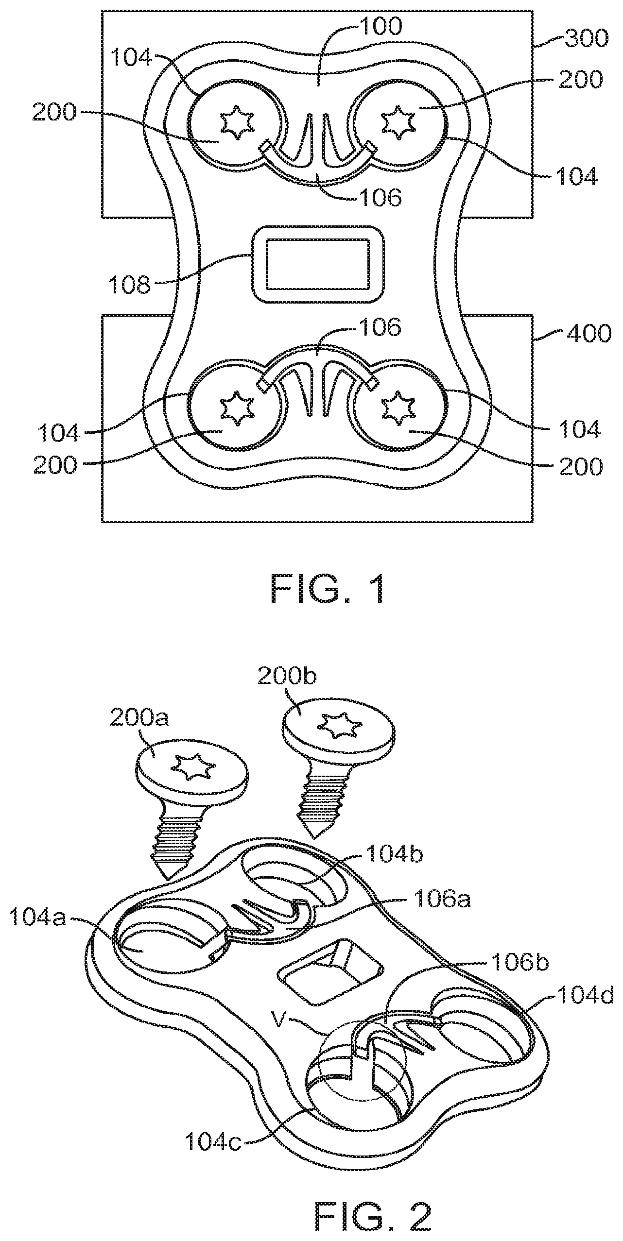 Patent US12396769 Figure 1 – Bone fixation systems and methods