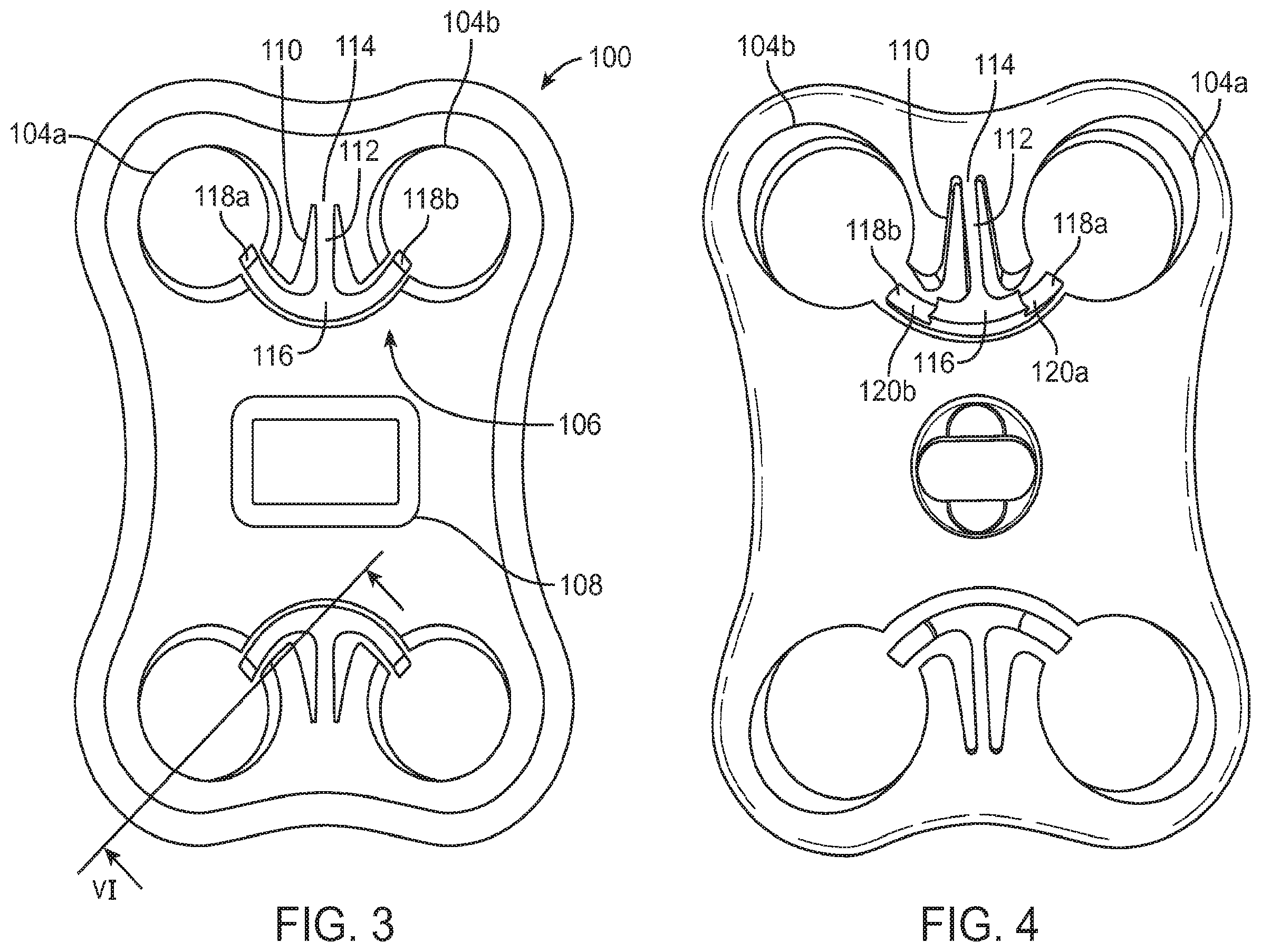 Patent US12396769 Figure 2 – Bone fixation systems and methods