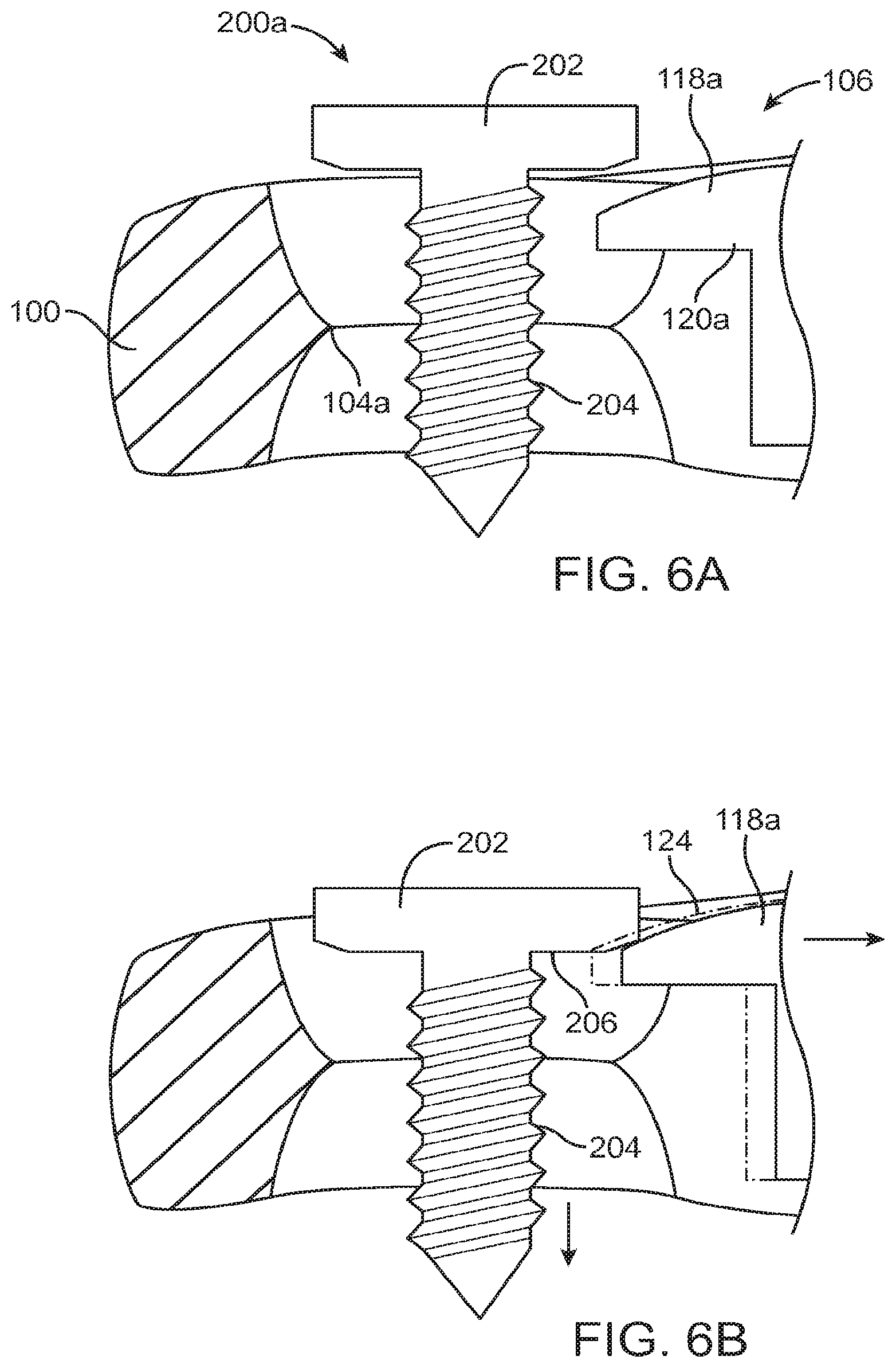 Patent US12396769 Figure 4 – Bone fixation systems and methods