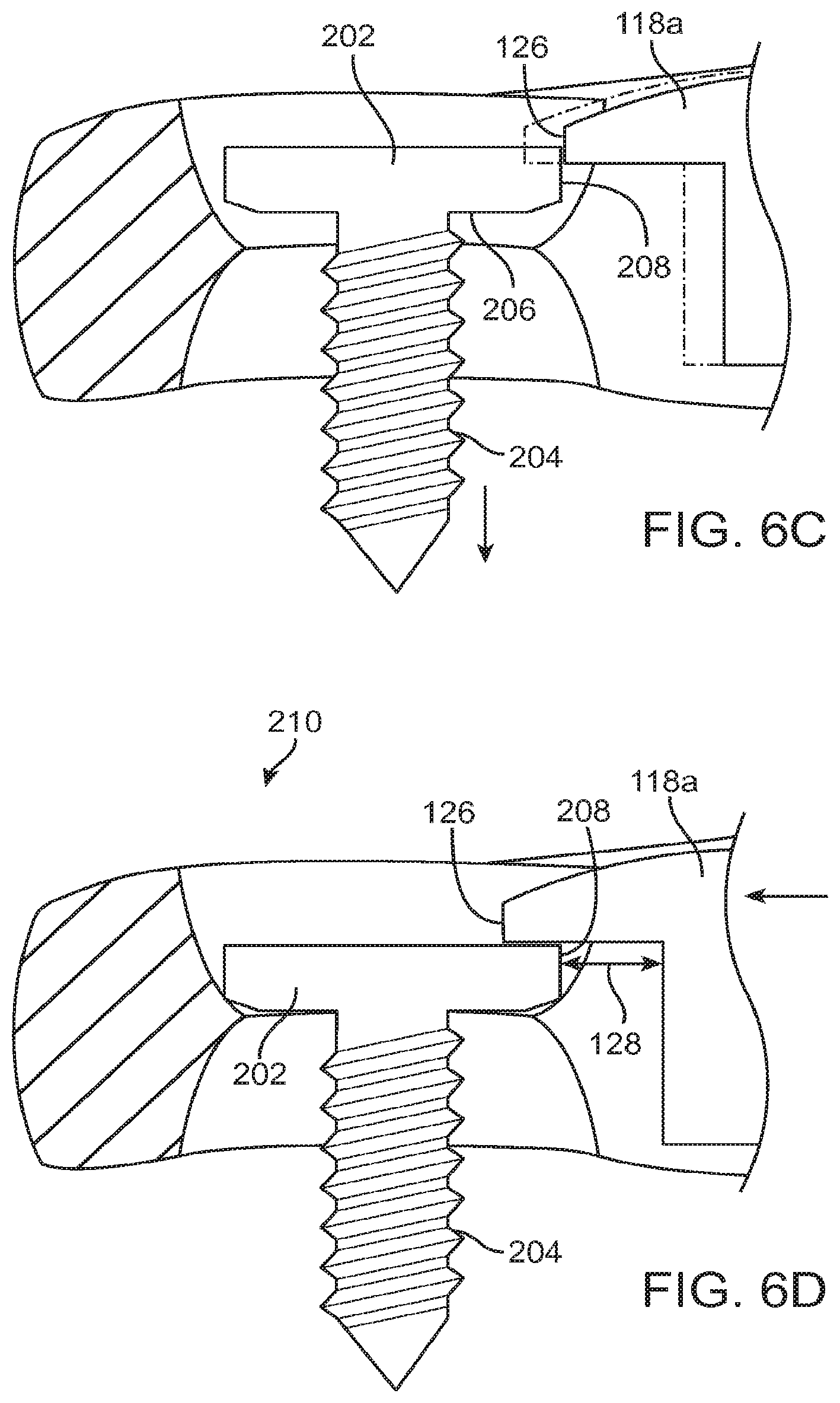 Patent US12396769 Figure 5 – Bone fixation systems and methods