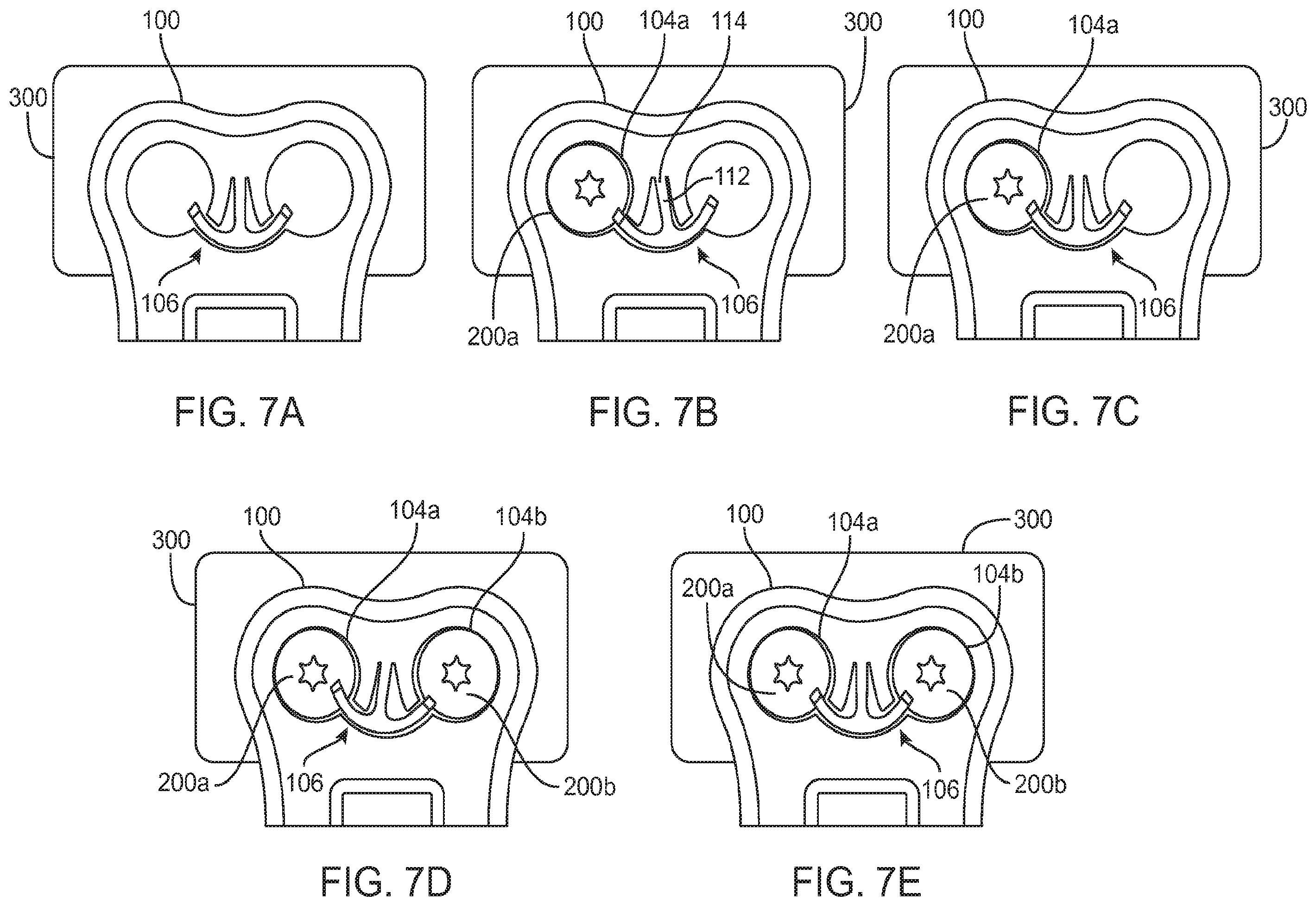 Patent US12396769 Figure 6 – Bone fixation systems and methods