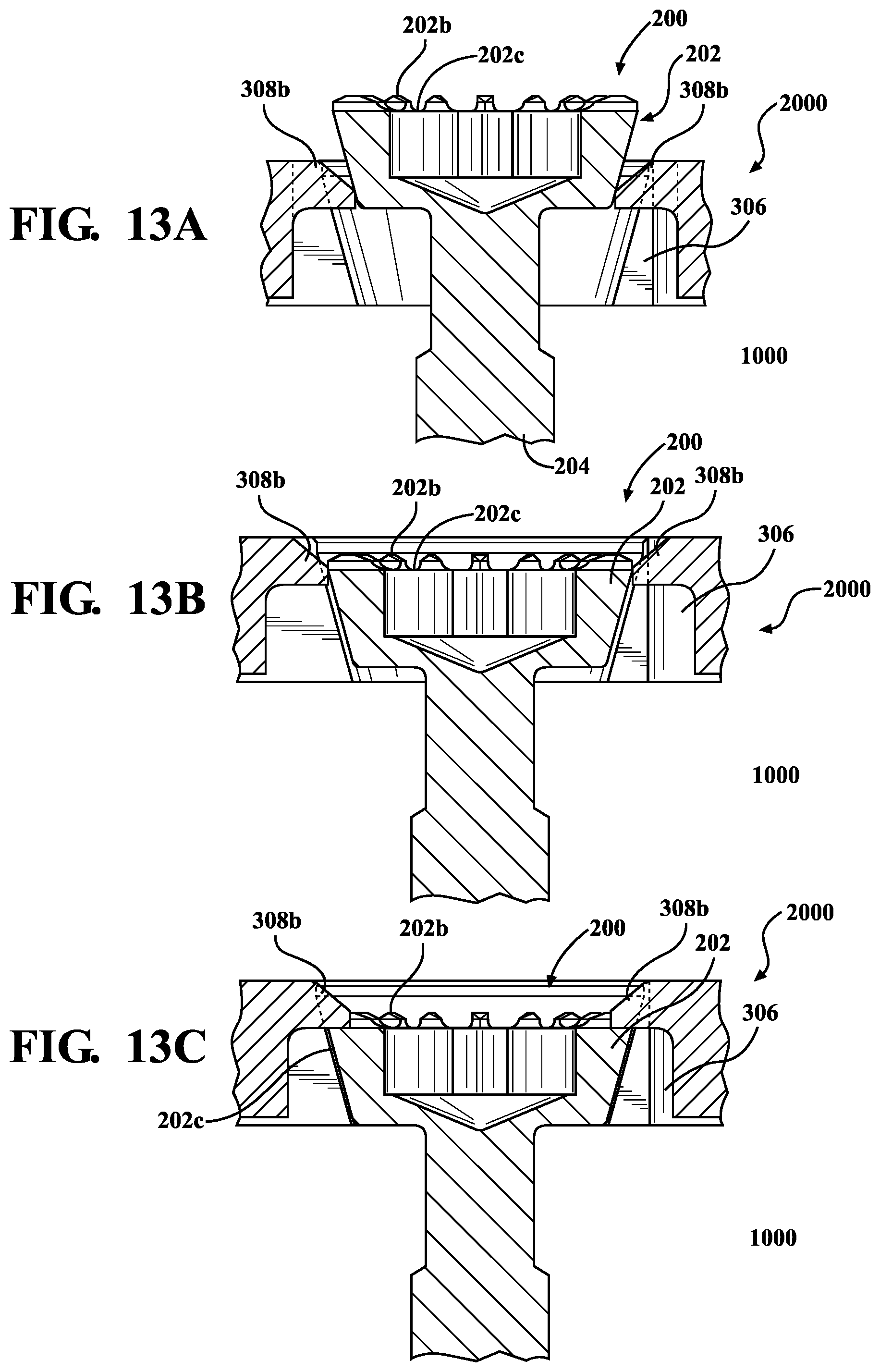 Patent US12396769 Figure 10 – Bone fixation systems and methods