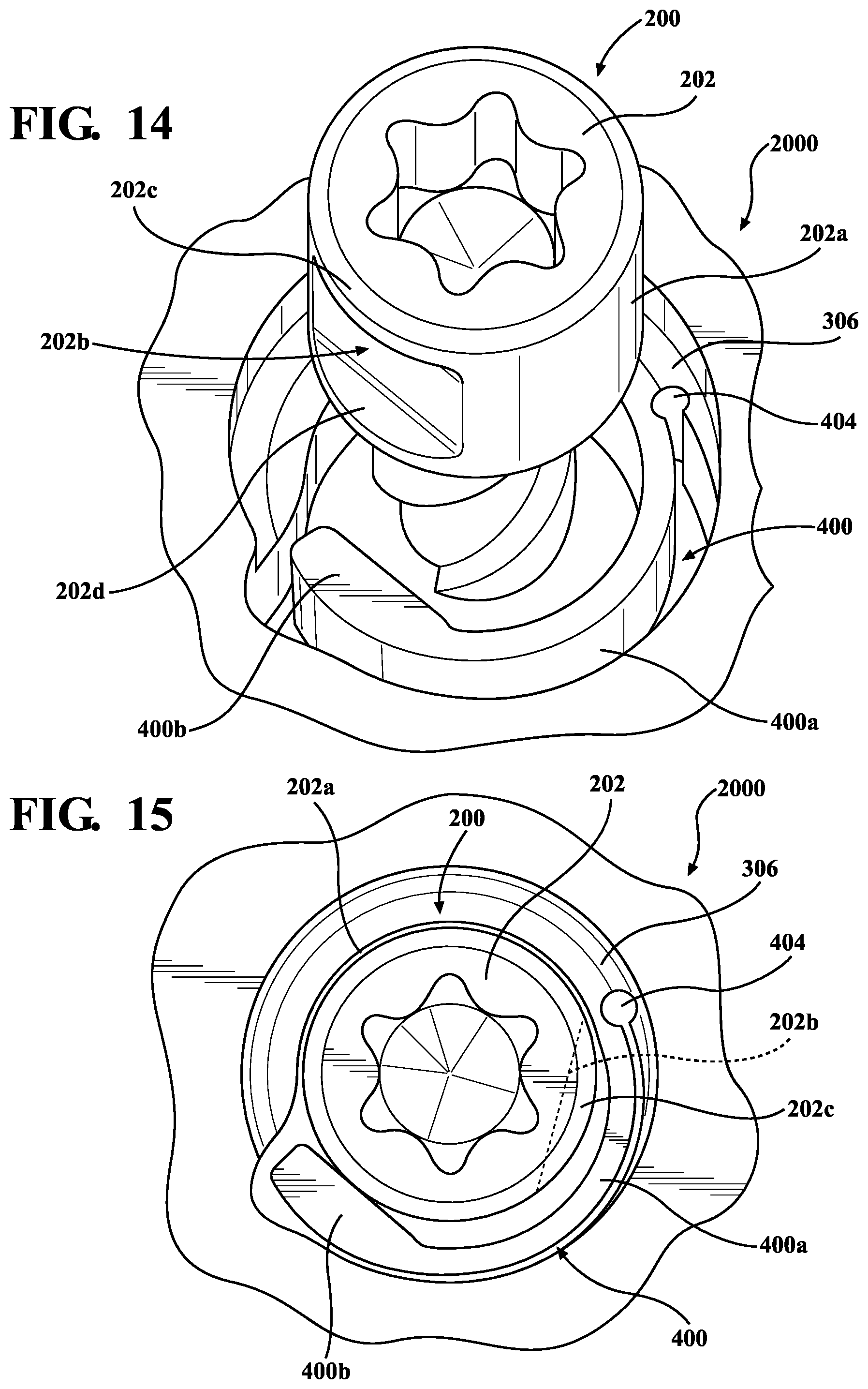 Patent US12396769 Figure 11 – Bone fixation systems and methods