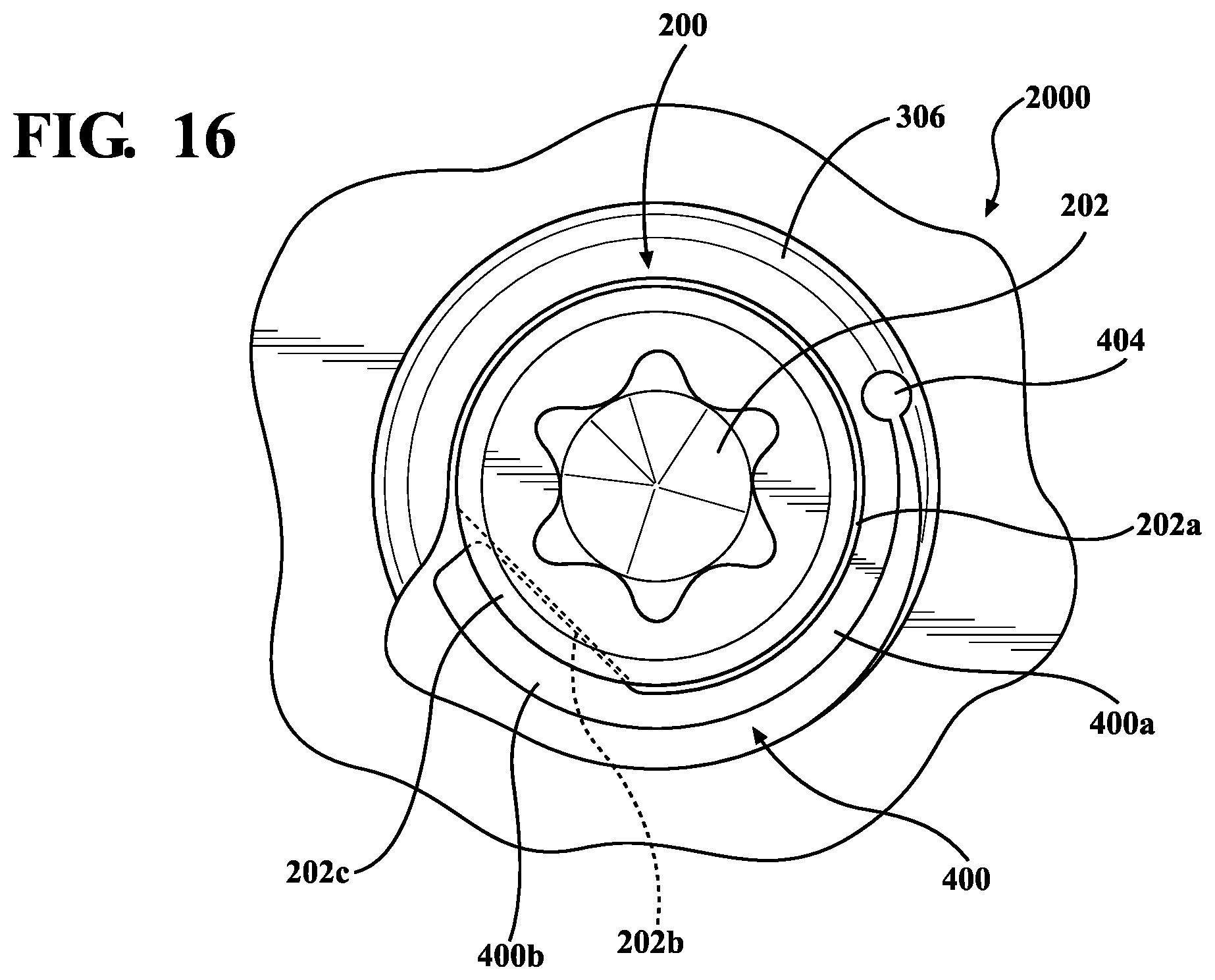 Patent US12396769 Figure 12 – Bone fixation systems and methods