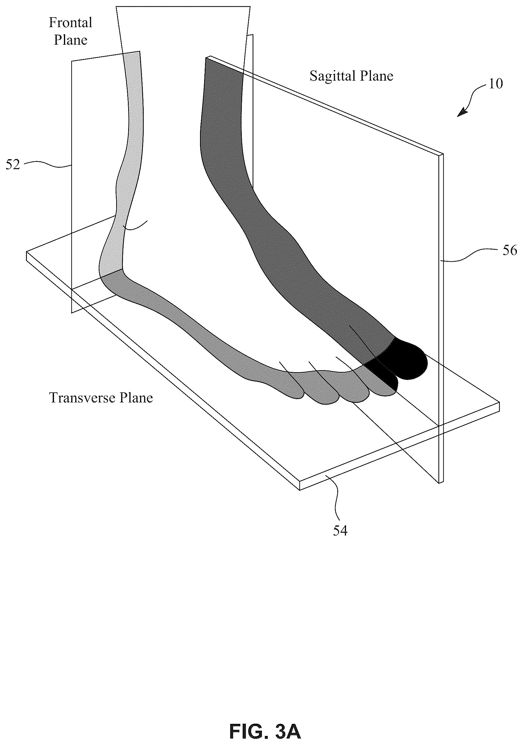 Patent US12396770 Figure 3 – Devices and techniques for treating metatarsus adductus