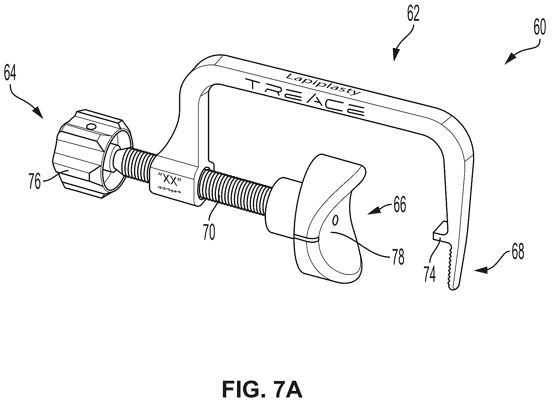Patent US12396770 Figure 12 – Devices and techniques for treating metatarsus adductus
