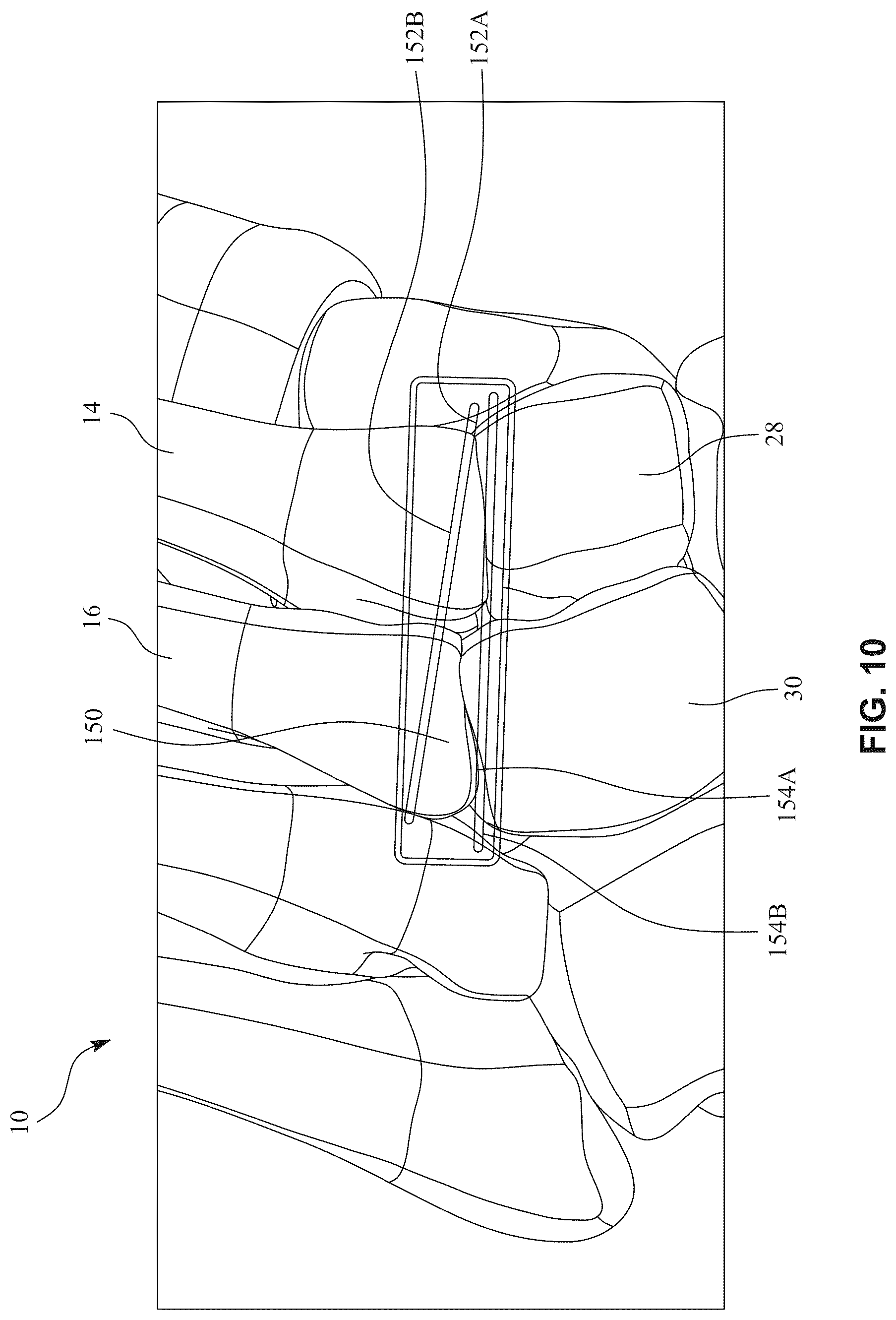 Patent US12396770 Figure 17 – Devices and techniques for treating metatarsus adductus