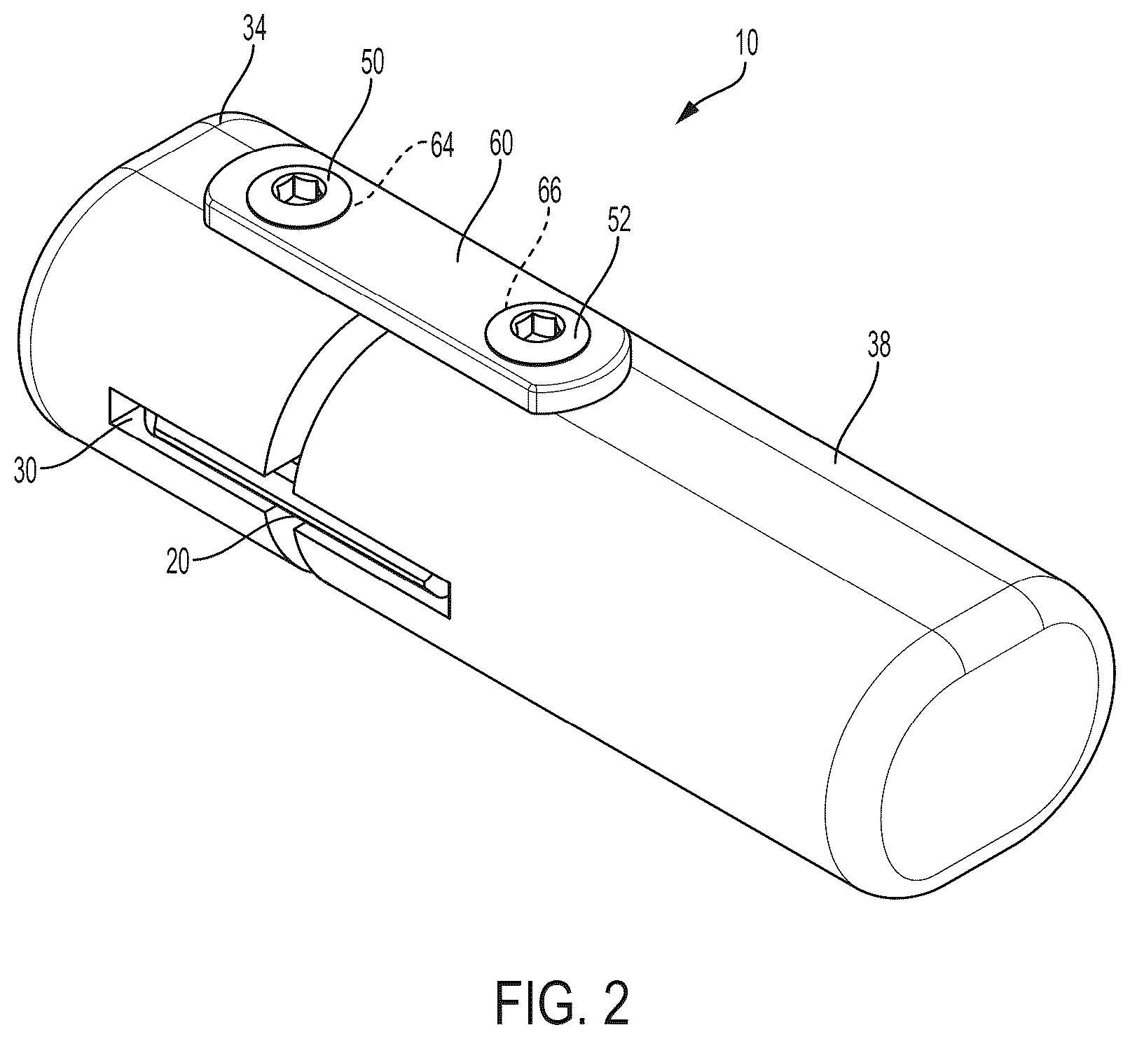 Patent US12396771 Figure 2 – Intra-osseous plate system and method