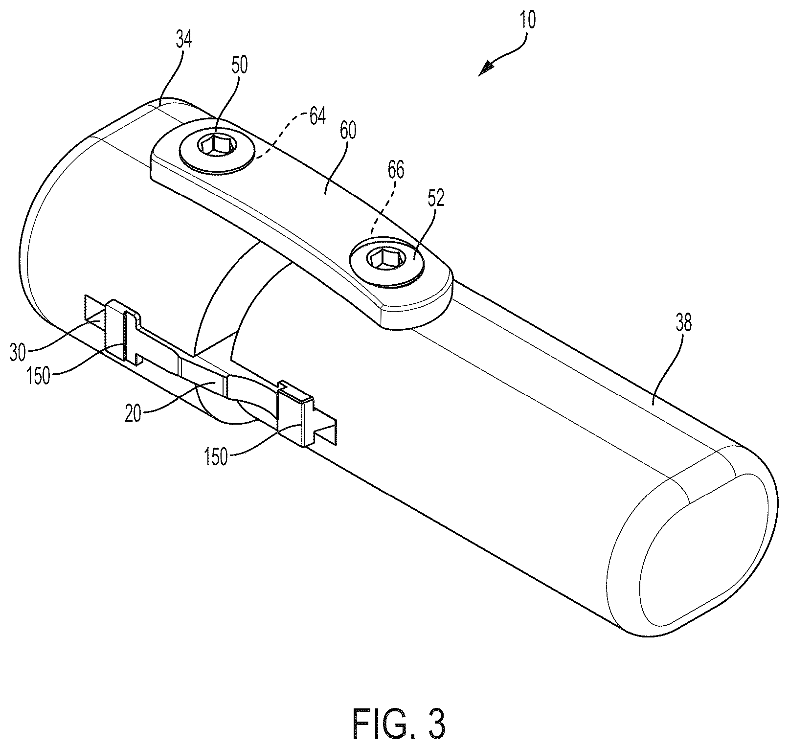 Patent US12396771 Figure 3 – Intra-osseous plate system and method