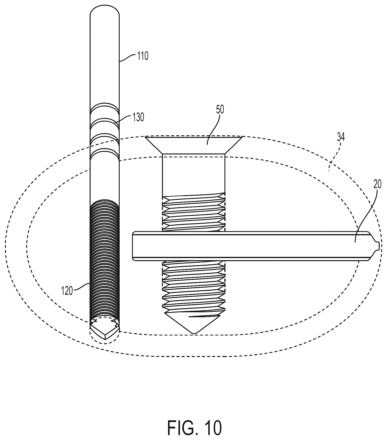 Patent US12396771 Figure 8 – Intra-osseous plate system and method